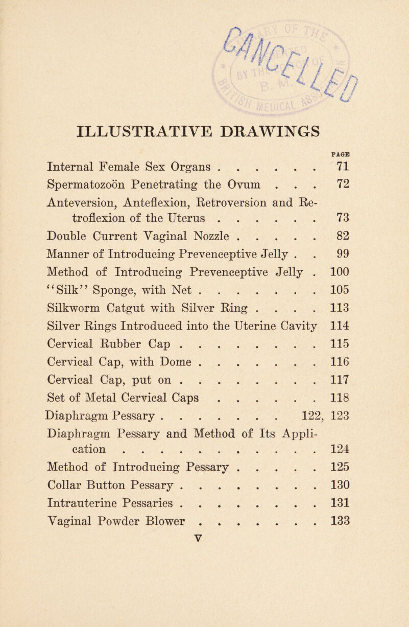 ILLUSTRATIVE DRAWINGS PAGE Internal Female Sex Organs.71 Spermatozoon Penetrating the Ovum ... 72 Anteversion, Anteflexion, Retroversion and Re¬ troflexion of the Uterus.73 Double Current Vaginal Nozzle ..... 82 Manner of Introducing Prevenceptive Jelly . . 99 Method of Introducing Prevenceptive Jelly . 100 “Silk” Sponge, with Net.105 Silkworm Catgut with Silver Ring . . . . 113 Silver Rings Introduced into the Uterine Cavity 114 Cervical Rubber Cap.115 Cervical Cap, with Dome.116 Cervical Cap, put on . 117 Set of Metal Cervical Caps.118 Diaphragm Pessary . . . . . . . 122, 123 Diaphragm Pessary and Method of Its Appli¬ cation .124 Method of Introducing Pessary.125 Collar Button Pessary.130 Intrauterine Pessaries.131 Vaginal Powder Blower.133