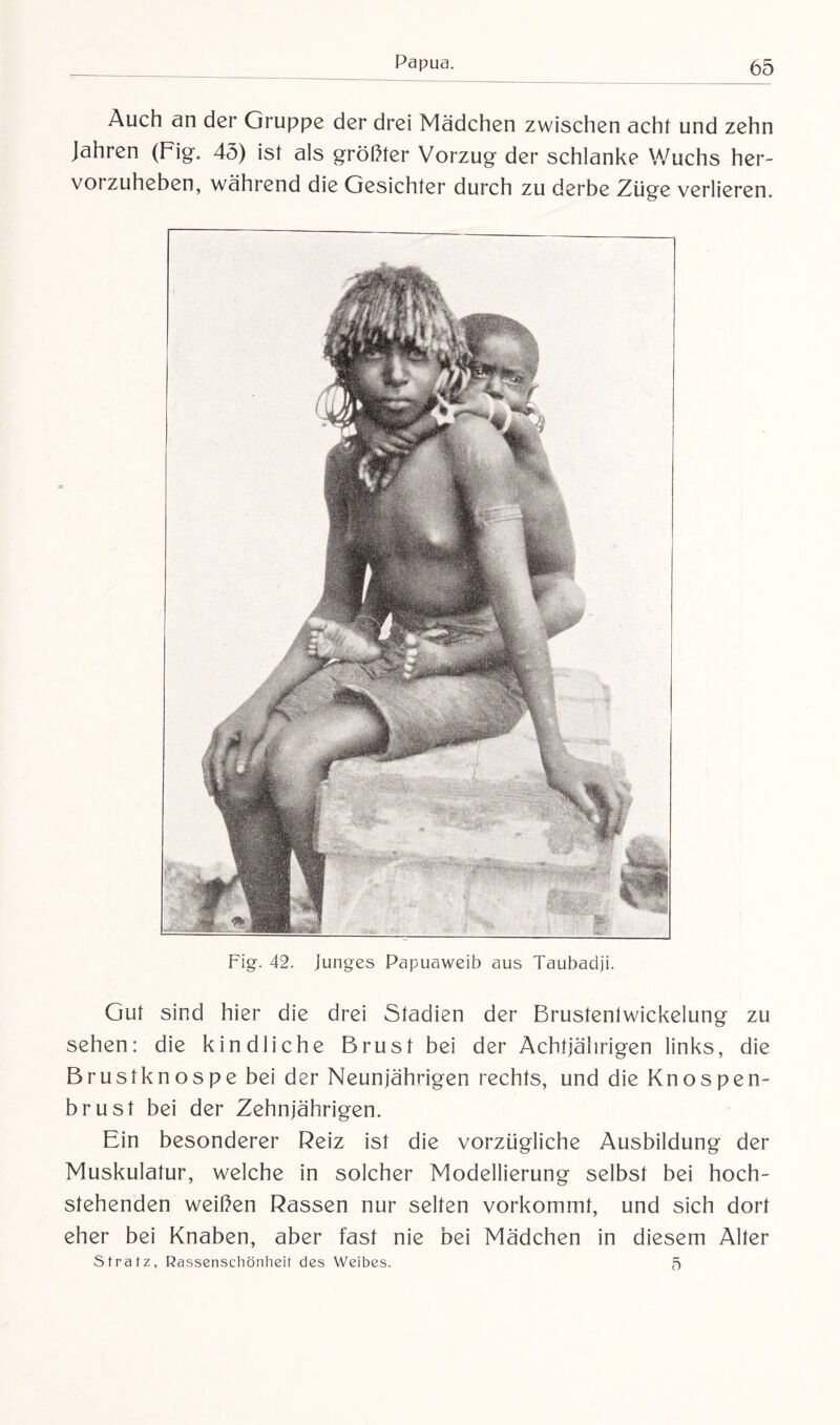 Auch an der Gruppe der drei Mädchen zwischen acht und zehn Jahren (Fig. 45) ist als größter Vorzug der schlanke Wuchs her¬ vorzuheben, während die Gesichter durch zu derbe Züge verlieren. Fig. 42. junges Papuaweib aus Taubadji. Gut sind hier die drei Stadien der Brustenlwickelung zu sehen: die kindliche Brust bei der Achtjährigen links, die Brustknospe bei der Neunjährigen rechts, und die Knospen¬ brust bei der Zehnjährigen. Ein besonderer Reiz ist die vorzügliche Ausbildung der Muskulatur, welche in solcher Modellierung selbst bei hoch¬ stehenden weißen Rassen nur selten vorkommt, und sich dort eher bei Knaben, aber fast nie bei Mädchen in diesem Alter Stratz, Rassenschönheif des Weibes. 5