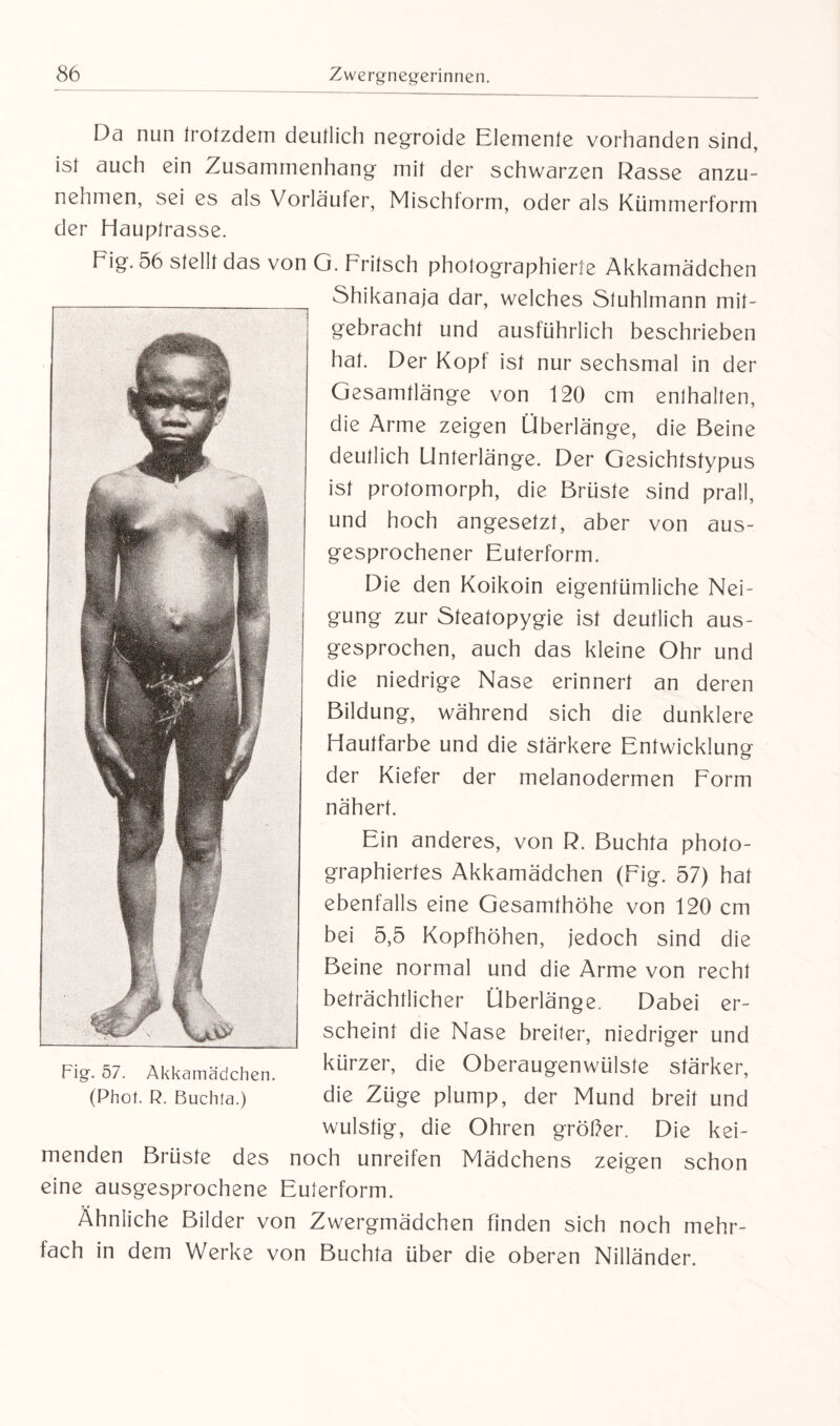 Da nun trotzdem deutlich negroide Elemente vorhanden sind, ist auch ein Zusammenhang mit der schwarzen Rasse anzu¬ nehmen, sei es als Vorläufer, Mischform, oder als Kümmerform der Hauptrasse. Fig. 56 stellt das von G. Fritsch photographierte Akkamädchen Shikanaja dar, welches Stuhlmann mit¬ gebracht und ausführlich beschrieben hat. Der Kopf ist nur sechsmal in der Gesamtlänge von 120 cm enthalten, die Arme zeigen Überlänge, die Beine deutlich Unterlänge. Der Gesichtstypus ist protomorph, die Brüste sind prall, und hoch angesetzt, aber von aus¬ gesprochener Euterform. Die den Koikoin eigentümliche Nei¬ gung zur Steatopygie ist deutlich aus¬ gesprochen, auch das kleine Ohr und die niedrige Nase erinnert an deren Bildung, während sich die dunklere Hautfarbe und die stärkere Entwicklung der Kiefer der melanodermen Form nähert. Ein anderes, von R. Buchta photo¬ graphiertes Akkamädchen (Fig. 57) hat ebenfalls eine Gesamthöhe von 120 cm bei 5,5 Kopfhöhen, jedoch sind die Beine normal und die Arme von recht beträchtlicher Liberlänge. Dabei er¬ scheint die Nase breiter, niedriger und kürzer, die Oberaugenwülste stärker, die Züge plump, der Mund breit und wulstig, die Ohren größer. Die kei¬ menden Brüste des noch unreifen Mädchens zeigen schon eine ausgesprochene Eulerform. Ähnliche Bilder von Zwergmädchen finden sich noch mehr¬ fach in dem Werke von Buchta über die oberen Nilländer. Fig. 57. Akkamädchen. (Phot. R. Buchta.)