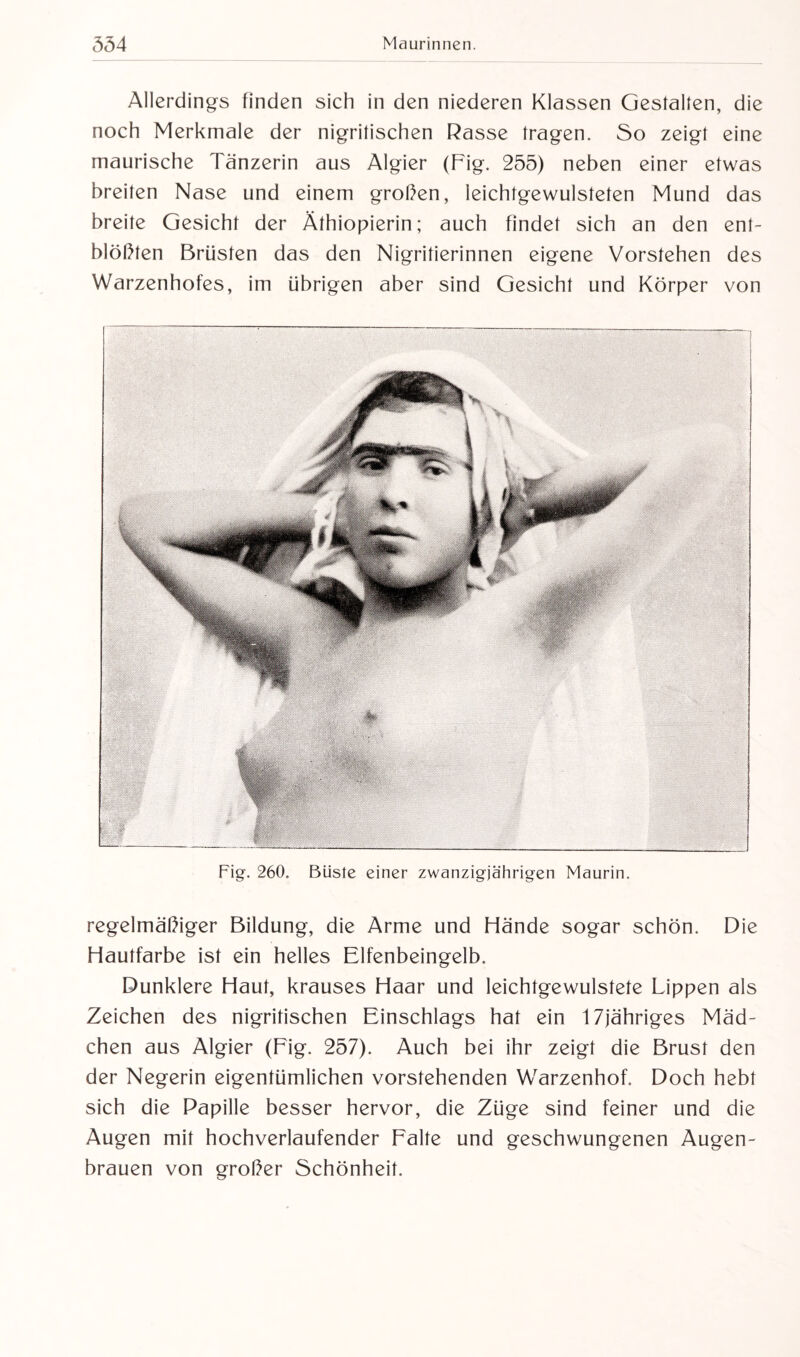 Allerdings finden sich in den niederen Klassen Gestalten, die noch Merkmale der nigritischen Rasse tragen. So zeigt eine maurische Tänzerin aus Algier (Fig. 255) neben einer etwas breiten Nase und einem groben, leichtgewulsteten Mund das breite Gesicht der Äthiopierin; auch findet sich an den ent¬ blößten Brüsten das den Nigritierinnen eigene Vorstehen des Warzenhofes, im übrigen aber sind Gesicht und Körper von Fig. 260. Büste einer zwanzigjährigen Maurin. regelmäßiger Bildung, die Arme und Hände sogar schön. Die Hautfarbe ist ein helles Elfenbeingelb. Dunklere Haut, krauses Haar und leichtgewulstete Lippen als Zeichen des nigritischen Einschlags hat ein 17jähriges Mäd¬ chen aus Algier (Fig. 257). Auch bei ihr zeigt die Brust den der Negerin eigentümlichen vorstehenden Warzenhof. Doch hebt sich die Papille besser hervor, die Züge sind feiner und die Augen mit hochverlaufender Falte und geschwungenen Augen¬ brauen von großer Schönheit.