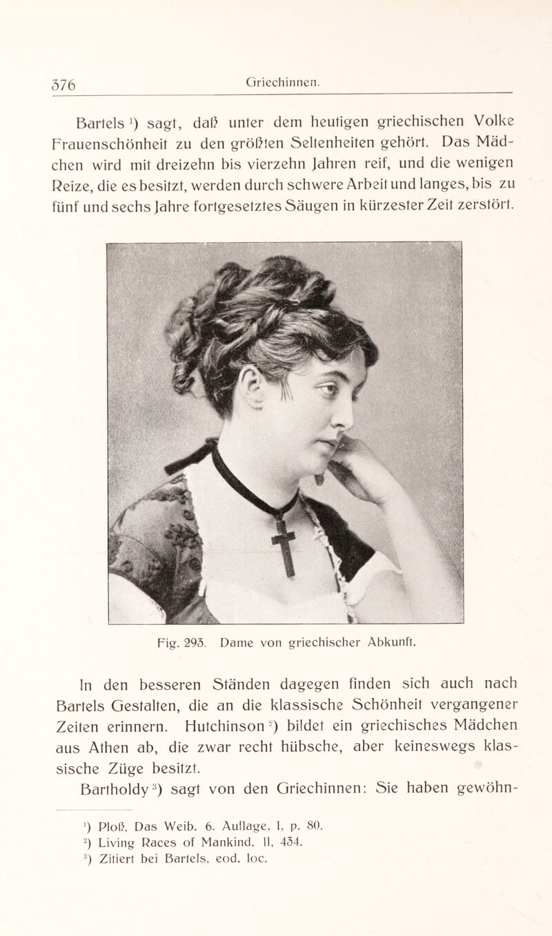 Bartels ]) sagt, dal) unter dem heutigen griechischen Volke Frauenschönheit zu den größten Seltenheiten gehört. Das Mäd¬ chen wird mit dreizehn bis vierzehn Jahren reif, und die wenigen Reize, die es besitzt, werden durch schwere Arbeit und langes, bis zu fünf und sechs Jahre fortgesetztes Säugen in kürzester Zeit zerstört. Fig. 295. Dame von griechischer Abkunft. In den besseren Ständen dagegen finden sich auch nach Bartels Gestalten, die an die klassische Schönheit vergangener Zeiten erinnern. Flutchinson s) bildet ein griechisches Mädchen aus Athen ab, die zwar recht hübsche, aber keineswegs klas¬ sische Züge besitzt. Bartholdy* 2 3) sagt von den Griechinnen: Sie haben gewöhn- ') Floß, Das Weib. 6. Auflage, I, p. 80. 2) Living Races of Mankind. II, 434. 3) Zitiert bei Bartels, eod. loc.