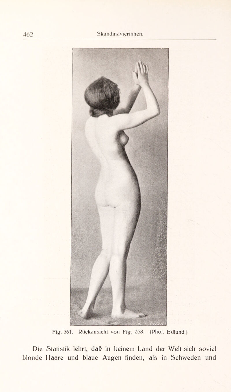 Fig. 561. Rückansicht von Fig. 558. (Phot. Edlund.) Die Statistik lehrt, daß in keinem Land der Welt sich soviel blonde Haare und blaue Augen finden, als in Schweden und
