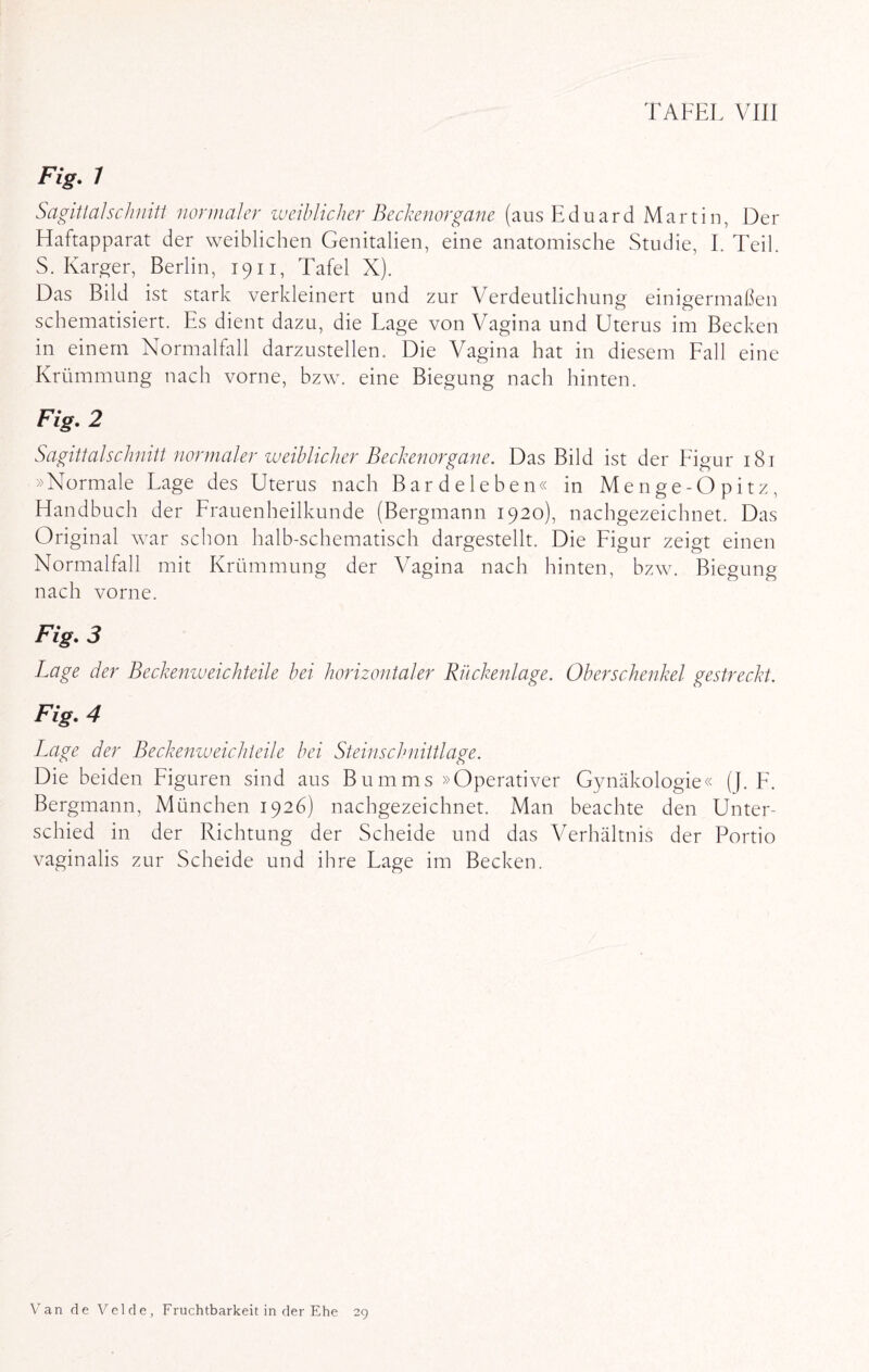 Fig. 1 Sagitlalschnitt normaler weiblicher Bechenorgane (aus Eduard Martin, Der Haftapparat der weiblichen Genitalien, eine anatomische Studie, I. Teil. S. Karger, Berlin, 1911, Tafel X). Das Bild ist stark verkleinert und zur Verdeutlichung einigermaßen schematisiert. Es dient dazu, die Lage von Vagina und Uterus im Becken in einem Normalfall darzustellen. Die Vagina hat in diesem Fall eine Krümmung nach vorne, bzw. eine Biegung nach hinten. Fig• 2 Sagittalschnitt normaler weiblicher Beckenorgane. Das Bild ist der Figur 181 »Normale Lage des Uterus nach Bardeleben« in Menge-Opitz, Handbuch der Frauenheilkunde (Bergmann 1920), nachgezeichnet. Das Original war schon halb-schematisch dargestellt. Die Figur zeigt einen Normalfall mit Krümmung der Vagina nach hinten, bzw. Biegung nach vorne. Fig. 3 Lage der Bechenweichteile bei horizontaler Buchenlage. Oberschenkel gestreckt. Fig. 4 Lage der Bechenweichteile bei Steinschnittlage. Die beiden Figuren sind aus Bumms »Operativer Gynäkologie« (J. F. Bergmann, München 1926) nachgezeichnet. Man beachte den Unter¬ schied in der Richtung der Scheide und das Verhältnis der Portio vaginalis zur Scheide und ihre Lage im Becken. Van de Velde, Fruchtbarkeit in der Ehe 29