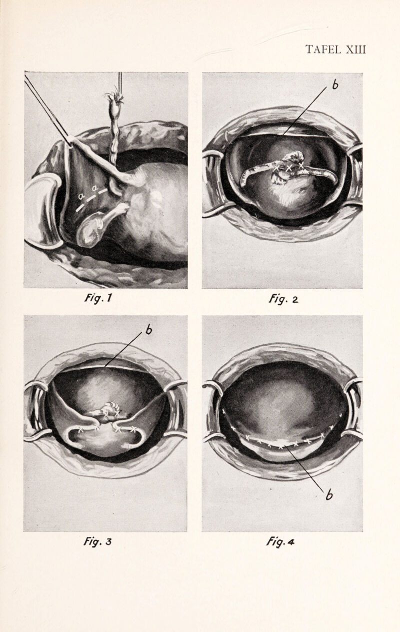 Fig. 3 fig.4.