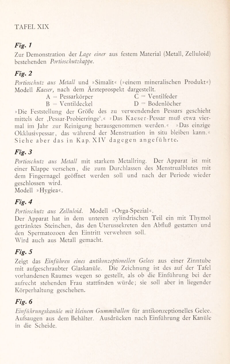 Fig. 1 Zur Demonstration der Lage einer aus festem Material (Metall, Zelluloid) bestehehden Portioschutzkappe. Fig. 2 Portioschutz aus Metall und »Simalit« (»einem mineralischen Produkt«) Modell Kaeser, nach dem Ärzteprospekt dargesteht. A = Pessarkörper C = Ventilfeder B = Ventildeckel D = Bodenlöcher »Die Feststellung der Größe des zu verwendenden Pessars geschieht mittels der ,Pessar-Probierringec.« »Das Kaeser-Pessar muß etwa vier¬ mal im Jahr zur Reinigung herausgenommen werden.« »Das einzige Okklusivpessar, das während der Menstruation in situ bleiben kann.« Siehe aber das in Kap. XIV dagegen angeführte. Fig. 3 Portioschutz aus Metall mit starkem Metallring. Der Apparat ist mit einer Klappe versehen , die zum Durchlässen des Menstrualblutes mit dem Fingernagel geöffnet wrerden soll und nach der Periode wieder geschlossen whrd. Modell »Hygiea«. Fig. 4 Portioschutz aus Zelluloid. Modell »Orga-Spezial«. Der Apparat hat in dem unteren zylindrischen Teil ein mit Thymol getränktes Sternchen, das den Uterussekreten den Abfluß gestatten und den Spermatozoen den Eintritt verwehren soll. Wird auch aus Metall gemacht. Fig. 5 Zeigt das Einführen eines antikonzeptionellen Gelees aus einer Zinntube mit aufgeschraubter Glaskanüle. Die Zeichnung ist des auf der Tafel vorhandenen Raumes wegen so gestellt, als ob die Einführung bei der aufrecht stehenden Frau stattfinden würde; sie soll aber in hegender Körperhaltung geschehen. Fig. 6 Einführungskanüle mit kleinem Gummiballon für antikonzeptionelles Gelee. Aufsaugen aus dem Behälter. Ausdrücken nach Einführung der Kanüle in die Scheide.