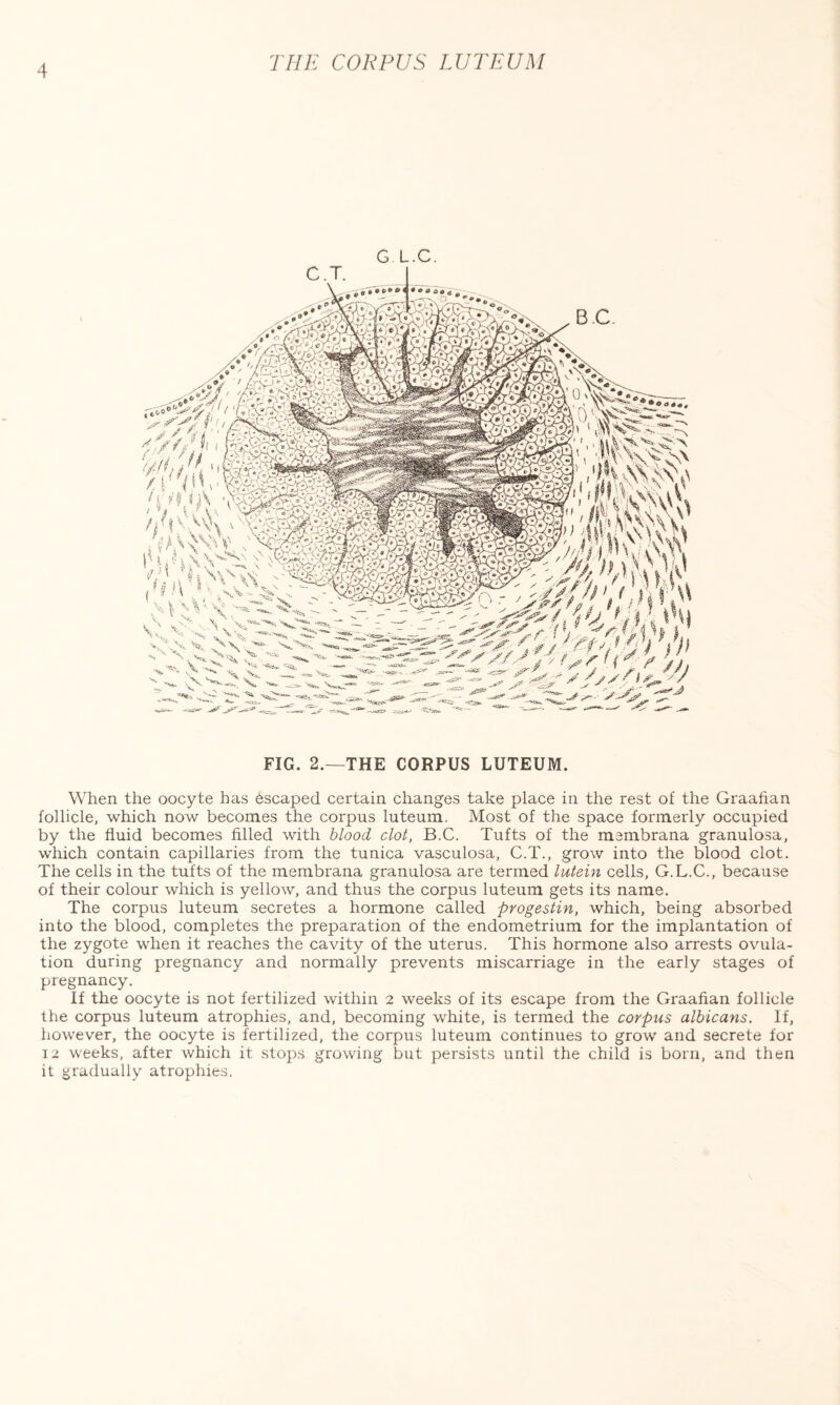 THE CORPUSLUTEUM G L.C. C\T- J ,.»*7 ‘I* ‘ *V .... *Vy,<^ii,4AFr»j*A. '»* ° rU ‘■ *■' * * \ Xi,-ti ,g».  tV* ' -v>> , - 1 x v'vfcGAt. ^ X k 'V |v. _a v, ^ ^ -***, ^ ^ — ___/* \ o^- , ,\ ' ~' - - X-X V ONO^' ->XS w ^ ' V^TX % ' * '^>v ^ '*-*■ ^ ^ v ' • >£. ’•*»* -- ^ “• O ^ t, V. - **  -V. x v XtV' _ , , ._, , , U» iHiiFcx 'jiWJi '.um X, - - / . P*$J t/i ’: |Ul 5X / ■fiva. -^I> ■«<•“ - ^«*w- #»»•' -y ./r > , . j % -x - -v. — — xx- ~ ^ -> s yy > /■/y ^ _ —'- n-c- ~ _r~ ~ ^ - y J- ^j •WiA- --ai**' - ~L«C- X'»o FIG. 2.—THE CORPUS LUTEUM. When the oocyte has Escaped certain changes take place in the rest of the Graafian follicle, which now becomes the corpus luteum. Most of the space formerly occupied by the fluid becomes filled with blood clot, B.C. Tufts of the membrana granulosa, which contain capillaries from the tunica vasculosa, C.T., grow into the blood clot. The cells in the tufts of the membrana granulosa are termed lutein cells, G.L.C., because of their colour which is yellow, and thus the corpus luteum gets its name. The corpus luteum secretes a hormone called progestin, which, being absorbed into the blood, completes the preparation of the endometrium for the implantation of the zygote when it reaches the cavity of the uterus. This hormone also arrests ovula¬ tion during pregnancy and normally prevents miscarriage in the early stages of pregnancy. If the oocyte is not fertilized within 2 weeks of its escape from the Graafian follicle the corpus luteum atrophies, and, becoming white, is termed the corpus albicans. If, however, the oocyte is fertilized, the corpus luteum continues to grow and secrete for 12 weeks, after which it stops growing but persists until the child is born, and then it gradually atrophies.