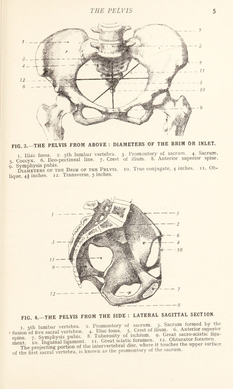 FIG. 3.—THE PELVIS FROM ABOVE : DIAMETERS OF THE BRIM OR INLET. 3 4 12 6 i Iliac fossa. 2. 5th lumbar vertebra. 3. Promontory of sacrum. 4. Sacrum. 5 Coccyx. 6. Ileo-pectineal line. 7. Crest of ilium. 8. Anterior superior spme. ^ Diameters of the Brim of the Pelvis. 10. True conjugate, 4 inches, n. Ou~ lique, 4\ inches. 12. Transverse, 5 inches. 4_the PELVIS FROM THE SIDE : LATERAL SAGITTAL SECTION. t eth lumbar vertebra. 2. Promontory of sacrum. 3- Sacrum formed by the fusion'of^hle^Lral veDebrm. 4. Iliac fossa. 5. Crest of ilium. 6. Anterior superior *stmohvsis pubis. 8. Tuberosity of ischium. 9. Great sacro-sciatic liga- inguinal ligament. 11. Great sciatic foramen. 12. Obturator foramen. The projecting portion of the intervertebral disc, where it touches the upper surface of the first sacral vertebra, is known as the promontory of the sacrum.