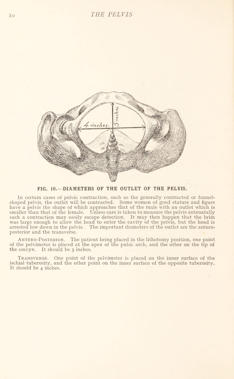 FIG. 10.—DIAMETERS OF THE OUTLET OF THE PELVIS. In certain cases of pelvic contraction, such as the generally contracted or funnel- shaped pelvis, the outlet will be contracted. Some women of good stature and figure have a pelvis the shape of which approaches that of the male with an outlet which is smaller than that of the female. Unless care is taken to measure the pelvis antenatally such a contraction may easily escape detection. It may then happen that the brim was large enough to allow the head to enter the cavity of the pelvis, but the head is arrested low down in the pelvis. The important diameters of the outlet are the antero¬ posterior and the transverse. Antero-Posterior. The patient being placed in the lithotomy position, one point of the pelvimeter is placed at the apex of the pubic arch, and the other on the tip of the coccyx. It should be 5 inches. Transverse. One point of the pelvimeter is placed on the inner surface of the ischial tuberosity, and the other point on the inner surface of the opposite tuberosity.