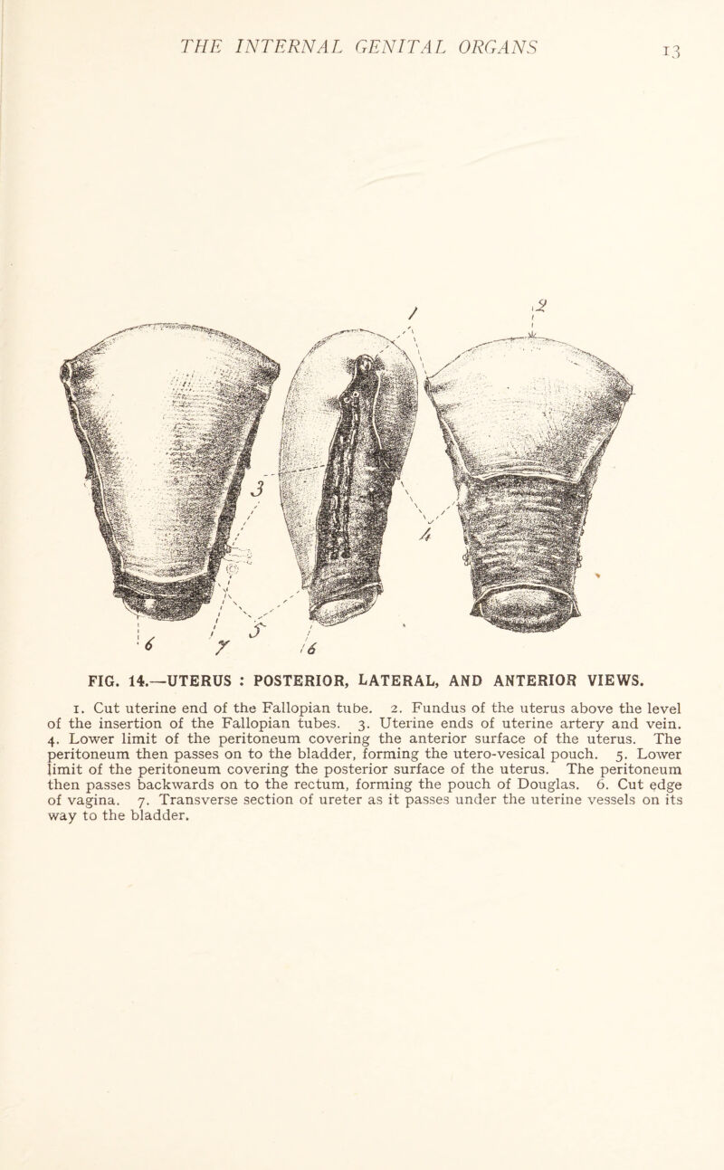 FIG. 14.—UTERUS : POSTERIOR, LATERAL, AND ANTERIOR VIEWS. i. Cut uterine end of the Fallopian tube. 2. Fundus of the uterus above the level of the insertion of the Fallopian tubes. 3. Uterine ends of uterine artery and vein. 4. Lower limit of the peritoneum covering the anterior surface of the uterus. The peritoneum then passes on to the bladder, forming the utero-vesical pouch. 5. Lower limit of the peritoneum covering the posterior surface of the uterus. The peritoneum then passes backwards on to the rectum, forming the pouch of Douglas. 6. Cut edge of vagina. 7. Transverse section of ureter as it passes under the uterine vessels on its way to the bladder.