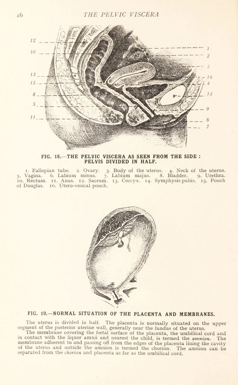 FIG. 18.—THE PELVIC VISCERA AS SEEN FROM THE SIDE : PELVIS DIVIDED IN HALF. i. Fallopian tube. 2. Ovary. 3. Body of the uterus. 4. Neck of the uterus. 5. Vagina. 6. Labium minus. 7. Labium majus. 8. Bladder. 9. Urethra. 10. Rectum. 11. Anus. 12. Sacrum. 13. Coccyx. 14. Symphysis pubis. 15. Pouch of Douglas. 16. Utero-vesical pouch. FIG. 19.—NORMAL SITUATION OF THE PLACENTA AND MEMBRANES. ilie uterus is divided in half. The placenta is normally situated on the upper segment of the posterior uterine wall, generally near the fundus of the uterus. The membrane covering the foetal surface of the placenta, the umbilical cord and in contact with the liquor amnii and nearest the child, is termed the amnion. The membrane adherent to and passing off from the edges of the placenta lining the cavity of the uterus and outside the amnion is termed the chorion. The amnion can be separated from the chorion and placenta as far as the umbilical cord.