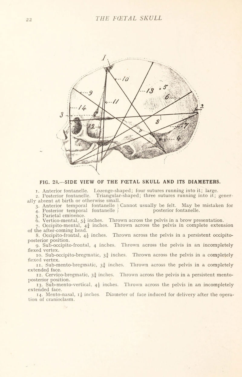 THE FCETAL SKULL FIG. 23.—SIDE VIEW OF THE FCETAL SKULL AND ITS DIAMETERS. 1. Anterior fontanelle. Lozenge-shaped; four sutures running into it; large. 2. Posterior fontanelle. Triangular-shaped; three sutures running into it; gener¬ al 13* absent at birth or otherwise small. 3. Anterior temporal fontanelle ) Cannot usually be felt. May be mistaken for 4. Posterior temporal fontanelle j posterior fontanelle. 5. Parietal eminence. 6. Vertico-mental, 5^ inches. Thrown across the pelvis in a brow presentation. 7. Occipito-mental, 4f inches. Thrown across the pelvis in complete extension of the after-coming head. 8. Occipito-frontal, 4! inches. Thrown across the pelvis in a persistent occipito- posterior position. 9. Sub-occipito-frontal, 4 inches. Thrown across the pelvis in an incompletely flexed vertex. 10. Sub-occipito-bregmatic, 3-f inches. Thrown across the pelvis in a completely flexed vertex. 11. Sub-mento-bregmatic, 3I inches. Thrown across the pelvis in a completely extended face. 12. Cervico-bregmatic, 3I inches. Thrown across the pelvis in a persistent mento¬ posterior position. 13. Sub-mento-vertical, 4^ inches. Thrown across the pelvis in an incompletely extended face. 14. Mento-nasal, i| inches, Diameter of face induced for delivery after the opera¬ tion of cranioclasm.