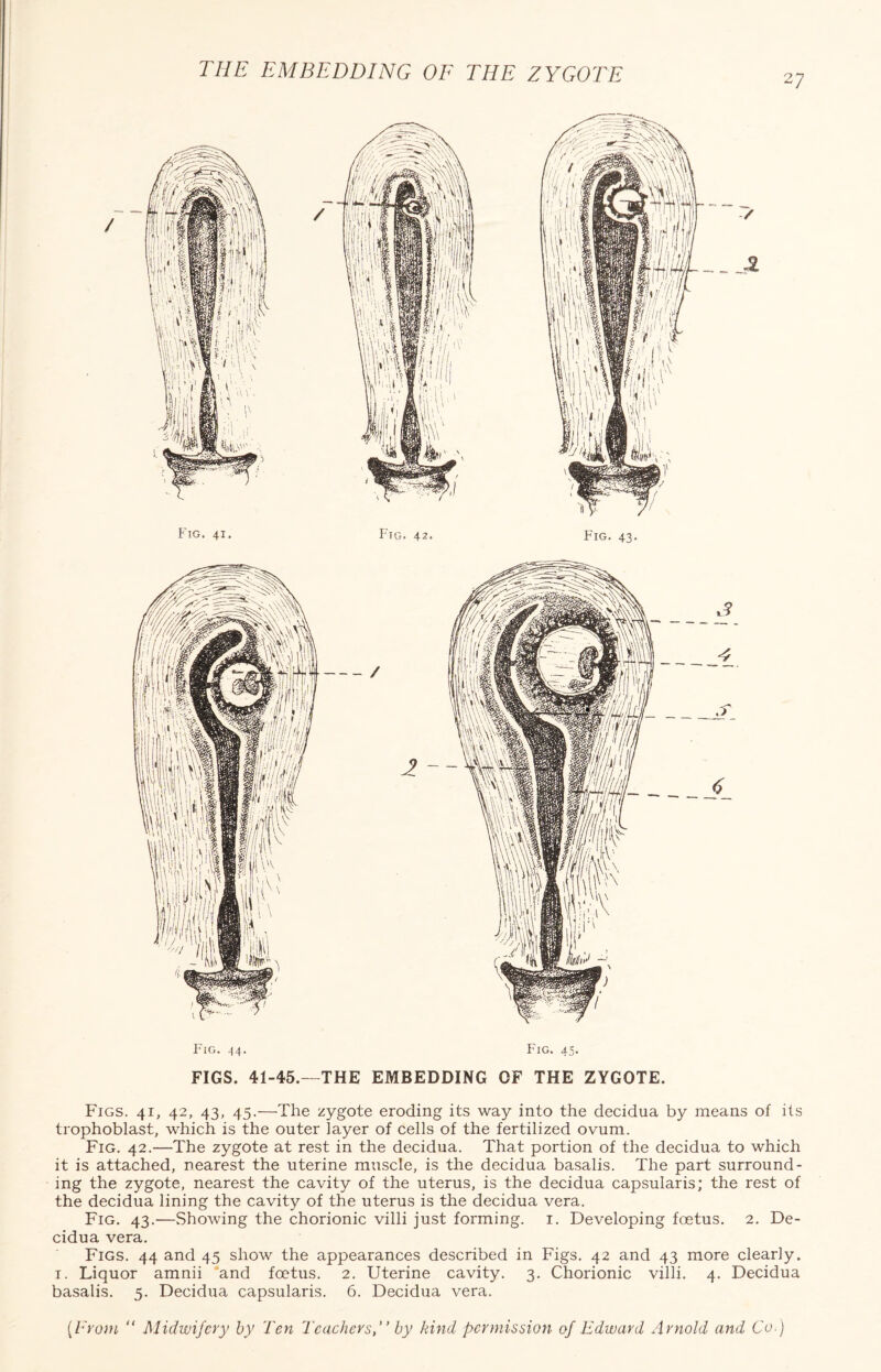 THE EMBEDDING OF THE ZYGOTE 27 / Fig. 41. Fig. 42. Fig. 43. Fig. 44. Fig. 45. FIGS. 41-45.—THE EMBEDDING OF THE ZYGOTE. Figs. 41, 42, 43, 45.—The zygote eroding its way into the decidua by means of its trophoblast, which is the outer layer of cells of the fertilized ovum. Fig. 42.—The zygote at rest in the decidua. That portion of the decidua to which it is attached, nearest the uterine muscle, is the decidua basalis. The part surround¬ ing the zygote, nearest the cavity of the uterus, is the decidua capsularis; the rest of the decidua lining the cavity of the uterus is the decidua vera. Fig. 43.—Showing the chorionic villi just forming. 1. Developing foetus. 2. De¬ cidua vera. Figs. 44 and 45 show the appearances described in Figs. 42 and 43 more clearly. 1. Liquor amnii and foetus. 2. Uterine cavity. 3. Chorionic villi. 4. Decidua basalis. 5. Decidua capsularis. 6. Decidua vera.