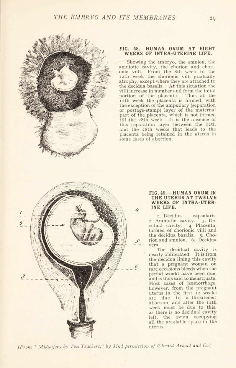 FIG. 48.—HUMAN OVUM AT EIGHT WEEKS OF INTRA-UTERINE LIFE. Showing the embryo, the amnion, the amniotic cavity, the chorion and chori¬ onic villi. From the 8th week to the 12th week the chorionic villi gradually atrophy, except where they are attached to the decidua basalis. At this situation the villi increase in number and form the foetal portion of the placenta. Thus at the 12th week the placenta is formed, with the exception of the ampullary (separation or postage-stamp) layer of the maternal part of the placenta, which is not formed till the 28th week. It is the absence of this separation layer between the 12th and the 28th weeks that leads to the placenta being retained in the uterus in some cases of abortion. 4 FIG. 49.-HUMAN OVUM IN THE UTERUS AT TWELVE WEEKS OF INTRA-UTER¬ INE LIFE. 1. Decidua capsularis. 2. Amniotic cavity. 3. De¬ cidual cavity. 4. Placenta, formed of chorionic villi and the decidua basalis. 5. Cho¬ rion and amnion. 6. Decidua vera. The decidual cavity is nearly obliterated. It is from the decidua lining this cavity that a pregnant woman on rare occasions bleeds when the period would have been due, and is thus said to menstruate. Most cases of haemorrhage, however, from the pregnant uterus in the first 12 weeks are due to a threatened abortion, and after the 12th week must be due to this, as there is no decidual cavity left, the ovum occupying all the available space in the uterus.