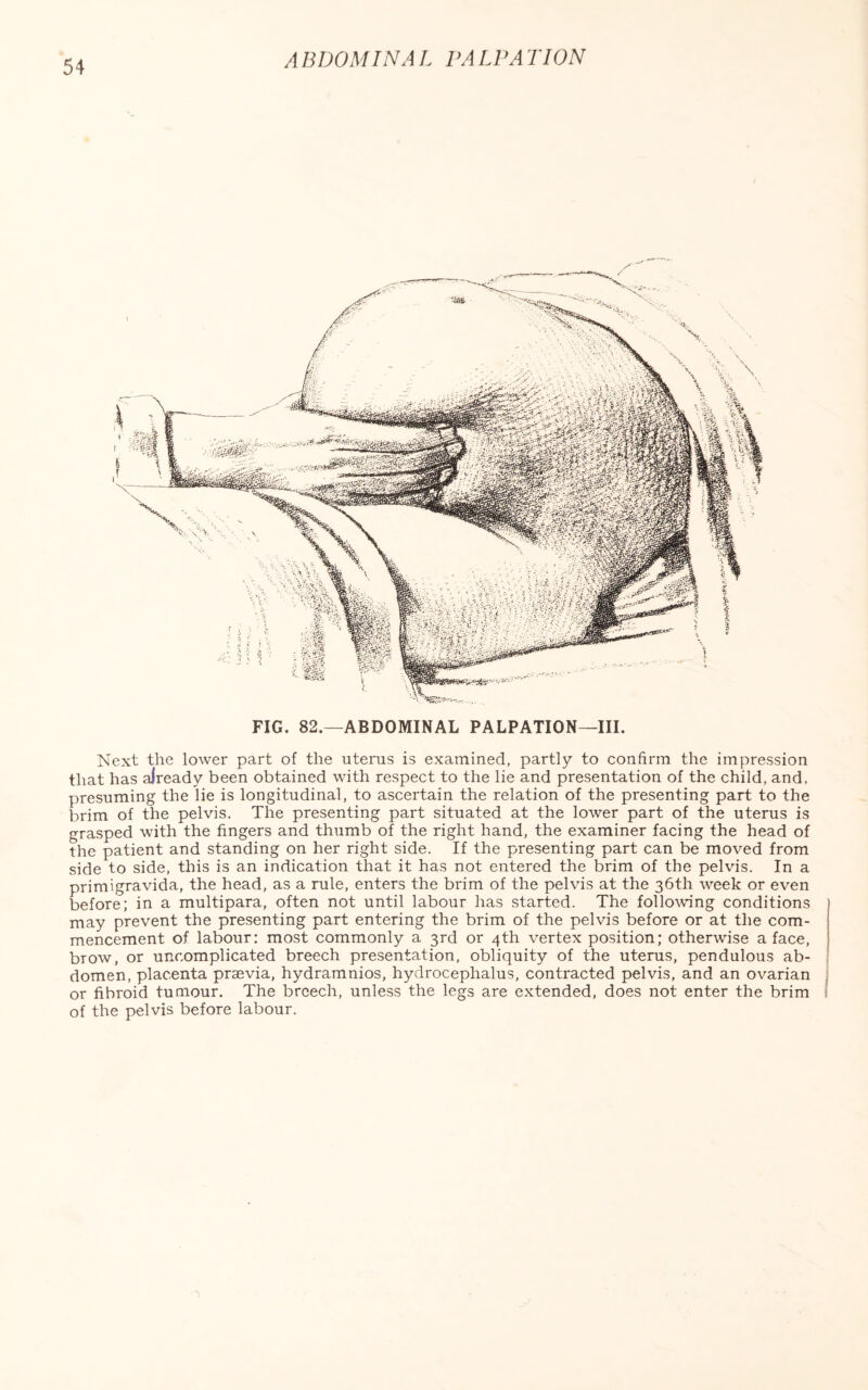 FIG. 82.—ABDOMINAL PALPATION—III. Next the lower part of the uterus is examined, partly to confirm the impression that has already been obtained with respect to the lie and presentation of the child, and, presuming the lie is longitudinal, to ascertain the relation of the presenting part to the brim of the pelvis. The presenting part situated at the lower part of the uterus is grasped with the fingers and thumb of the right hand, the examiner facing the head of the patient and standing on her right side. If the presenting part can be moved from side to side, this is an indication that it has not entered the brim of the pelvis. In a primigravida, the head, as a rule, enters the brim of the pelvis at the 36th week or even before; in a multipara, often not until labour has started. The following conditions may prevent the presenting part entering the brim of the pelvis before or at the com¬ mencement of labour: most commonly a 3rd or 4th vertex position; otherwise a face, brow, or uncomplicated breech presentation, obliquity of the uterus, pendulous ab¬ domen, placenta praevia, hydramnios, hydrocephalus, contracted pelvis, and an ovarian or fibroid tumour. The breech, unless the legs are extended, does not enter the brim of the pelvis before labour.