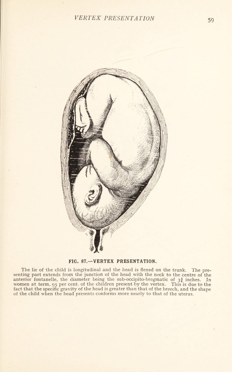 FIG. 87.—VERTEX PRESENTATION. The lie of the child is longitudinal and the head is flexed on the trunk. The pre¬ senting part extends from the junction of the head with the neck to the centre of the anterior fontanelle, the diameter being the sub-occipito-bregmatic of 3| inches. In women at term, 95 per cent, of the children present by the vertex. This is due to the fact that the specific gravity of the head is greater than that of the breech, and the shape of the child when the head presents conforms more nearly to that of the uterus.