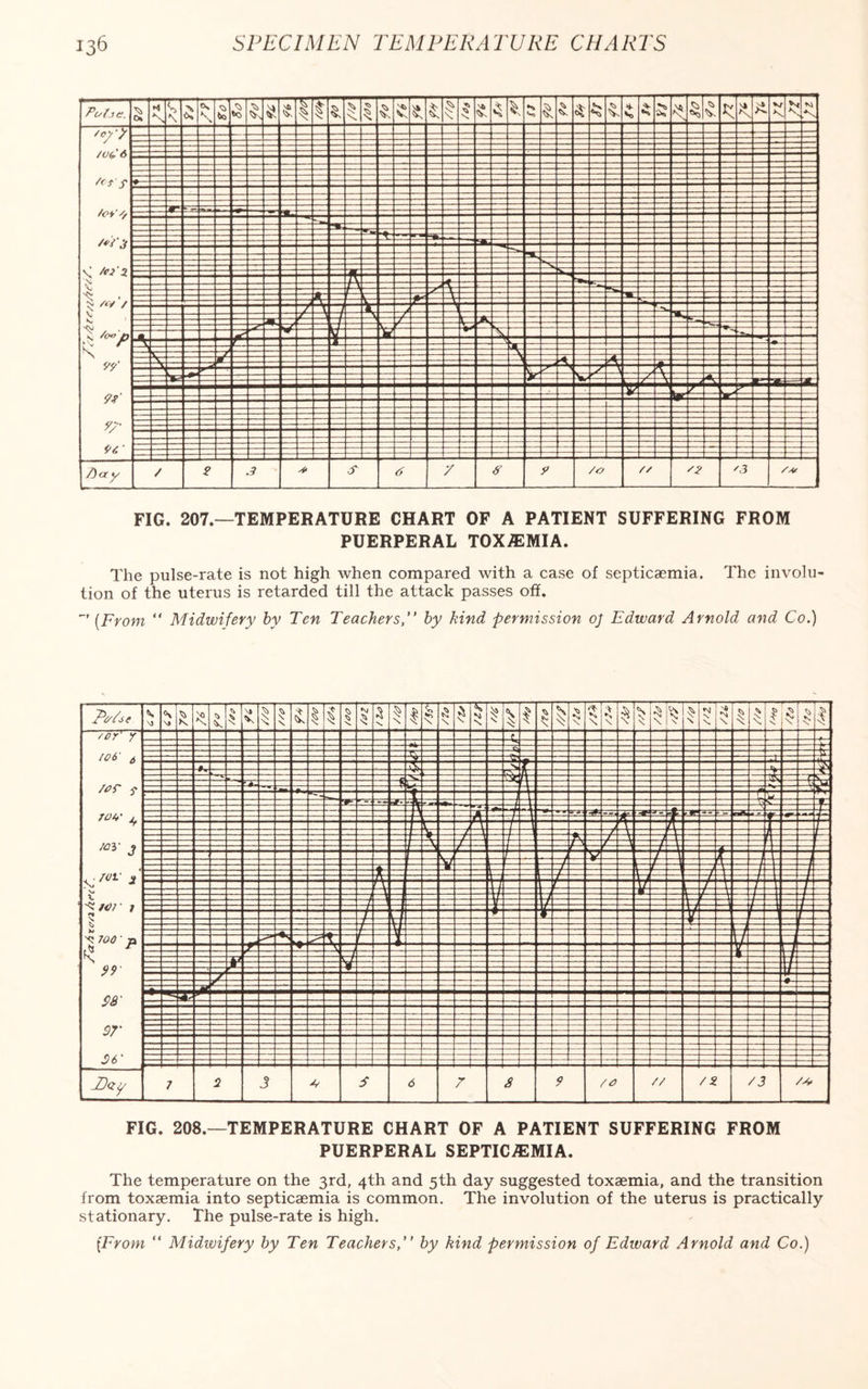 FIG. 207.—TEMPERATURE CHART OF A PATIENT SUFFERING FROM PUERPERAL TOXEMIA. The pulse-rate is not high when compared with a case of septicaemia. The involu¬ tion of the uterus is retarded till the attack passes off. ” (From “ Midwifery by Ten Teachers,'’ by kind permission oj Edward Arnold and Co.) FIG. 208.—TEMPERATURE CHART OF A PATIENT SUFFERING FROM PUERPERAL SEPTICAEMIA. The temperature on the 3rd, 4th and 5th day suggested toxaemia, and the transition from toxaemia into septicaemia is common. The involution of the uterus is practically stationary. The pulse-rate is high.