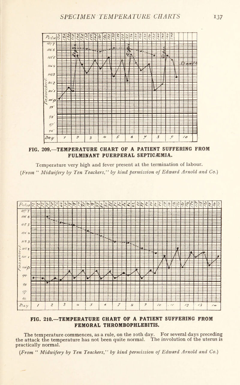 FIG. 209.—TEMPERATURE CHART OF A PATIENT SUFFERING FROM FULMINANT PUERPERAL SEPTICAEMIA. Temperature very high and fever present at the termination of labour. [From “ Midwifery by Ten Teachersby kind permission of Edward Arnold and Co.) FIG. 210.—TEMPERATURE CHART OF A PATIENT SUFFERING FROM FEMORAL THROMBOPHLEBITIS. The temperature commences, as a rule, on the 10th day. For several days preceding the attack the temperature has not been quite normal. The involution of the uterus is practically normal. {From “ Midwifery by Ten Teachers,” by kind permission of Edward Arnold and Co.)