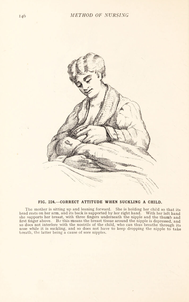 METHOD OF NURSING FIG. 224.—CORRECT ATTITUDE WHEN SUCKLING A CHILD. The mother is sitting up and leaning forward. She is holding her child so that its head rests on her arm, and its back is supported by her right hand. With her left hand she supports her breast, with three fingers underneath the nipple and the thumb and first linger above. By this means the breast tissue around the nipple is depressed, and so does not interfere with the nostrils of the child, who can thus breathe through its nose while it is suckling, and so does not have to keep dropping the nipple to take breath, the latter being a cause of sore nipples.
