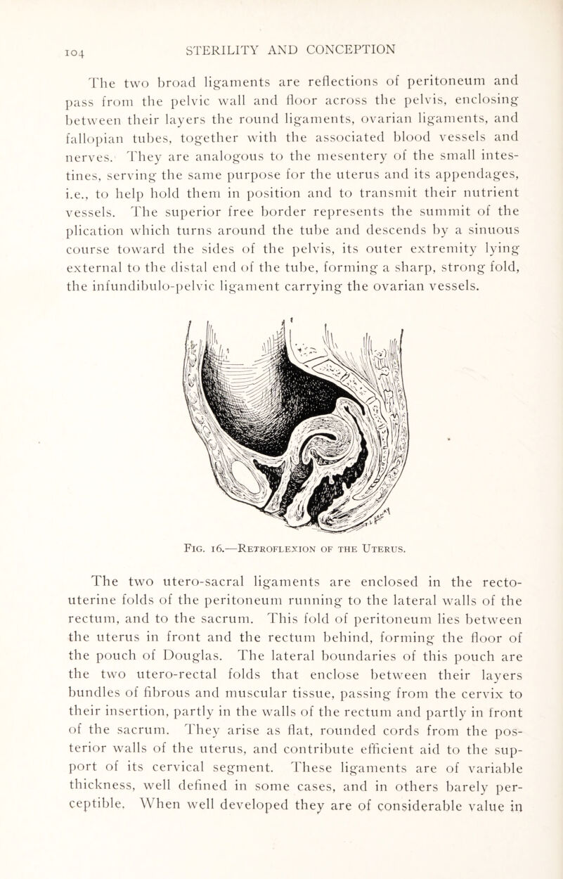The two broad ligaments are reflections of peritoneum and pass from the pelvic wall and floor across the pelvis, enclosing between their layers the round ligaments, ovarian ligaments, and fallopian tubes, together with the associated blood vessels and nerves. They are analogous to the mesentery of the small intes¬ tines, serving the same purpose for the uterus and its appendages, i.e., to help hold them in position and to transmit their nutrient vessels. The superior free border represents the summit of the plication which turns around the tube and descends by a sinuous course toward the sides of the pelvis, its outer extremity lying external to the distal end of the tube, forming a sharp, strong fold, the infundibulo-pelvic ligament carrying the ovarian vessels. Fig. i 6.—Retroflexion of the Uterus. The two utero-sacral ligaments are enclosed in the recto¬ uterine folds of the peritoneum running to the lateral walls of the rectum, and to the sacrum. This fold of peritoneum lies between the uterus in front and the rectum behind, forming the floor of the pouch of Douglas. The lateral boundaries of this pouch are the two utero-rectal folds that enclose between their layers bundles of fibrous and muscular tissue, passing from the cervix to their insertion, partly in the walls of the rectum and partly in front of the sacrum. They arise as flat, rounded cords from the pos¬ terior walls of the uterus, and contribute efficient aid to the sup¬ port of its cervical segment. These ligaments are of variable thickness, well defined in some cases, and in others barely per¬ ceptible. When well developed they are of considerable value in