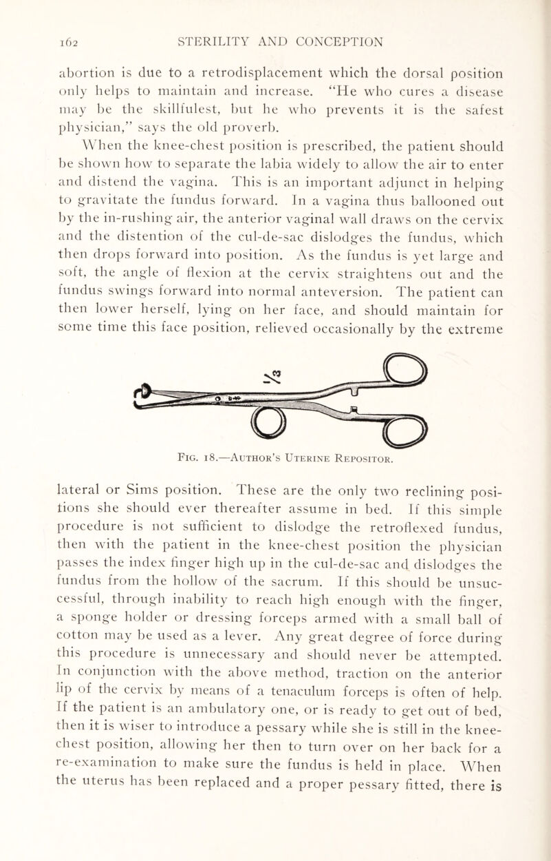 abortion is clue to a retrodisplacement which the dorsal position only helps to maintain and increase. “He who cures a disease may he the skillfulest, but he who prevents it is the safest physician,” says the old proverb. When the knee-chest position is prescribed, the patient should he shown how to separate the labia widely to allow the air to enter and distend the vagina. This is an important adjunct in helping to gravitate the fundus forward. In a vagina thus ballooned out by the in-rushing air, the anterior vaginal wall draws on the cervix and the distention of the cul-de-sac dislodges the fundus, which then drops forward into position. As the fundus is yet large and soft, the angle of flexion at the cervix straightens out and the fundus swings forward into normal anteversion. The patient can then lower herself, lying* on her face, and should maintain for some time this face position, relieved occasionally by the extreme lateral or Sims position. These are the only two reclining posi¬ tions she should ever thereafter assume in bed. If this simple procedure is not sufficient to dislodge the retroflexed fundus, then with the patient in the knee-chest position the physician passes the index finger high up in the cul-de-sac and dislodges the fundus from the hollow of the sacrum. If this should be unsuc¬ cessful, through inability to reach high enough with the finger, a sponge holder or dressing forceps armed with a small ball of cotton may be used as a lever. Any great deg*ree of force during this procedure is unnecessary and should never be attempted. In conjunction with the above method, traction on the anterior iip of the cervix by means of a tenaculum forceps is often of help, if the patient is an ambulatory one, or is ready to get out of bed, then it is wiser to introduce a pessary while she is still in the knee- chest position, allowing her then to turn over on her back for a re-examination to make sure the fundus is held in place. When the uterus has been replaced and a proper pessary fitted, there is