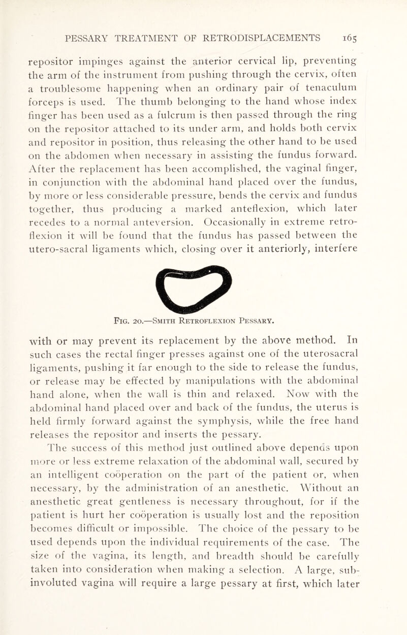 repositor impinges against the anterior cervical lip, preventing the arm of the instrument from pushing through the cervix, often a troublesome happening when an ordinary pair of tenaculum forceps is used. The thumb belonging to the hand whose index finger has been used as a fulcrum is then passed through the ring on the repositor attached to its under arm, and holds both cervix and repositor in position, thus releasing the other hand to be used on the abdomen when necessary in assisting the fundus forward. After the replacement has been accomplished, the vaginal finger, in conjunction with the abdominal hand placed over the fundus, by more or less considerable pressure, bends the cervix and fundus together, thus producing a marked anteflexion, which later recedes to a normal anteversion. Occasionally in extreme retro¬ flexion it will be found that the fundus has passed between the utero-sacral ligaments which, closing over it anteriorly, interfere Fig. 20.—Smith Retroflexion Pessary. with or may prevent its replacement by the above method. In such cases the rectal finger presses against one of the uterosacral ligaments, pushing it far enough to the side to release the fundus, or release may be effected by manipulations with the abdominal hand alone, when the wall is thin and relaxed. Now with the abdominal hand placed over and back of the fundus, the uterus is held firmly forward against the symphysis, while the free hand releases the repositor and inserts the pessary. The success of this method just outlined above depends upon more or less extreme relaxation of the abdominal wall, secured by an intelligent cooperation on the part of the patient or, when necessary, by the administration of an anesthetic. Without an anesthetic great gentleness is necessary throughout, for if the patient is hurt her cooperation is usually lost and the reposition becomes difficult or impossible. The choice of the pessary to be used depends upon the individual requirements of the case. The size of the vagina, its length, and breadth should he carefully taken into consideration when making a selection. A large, sub¬ involuted vagina will require a large pessary at first, which later