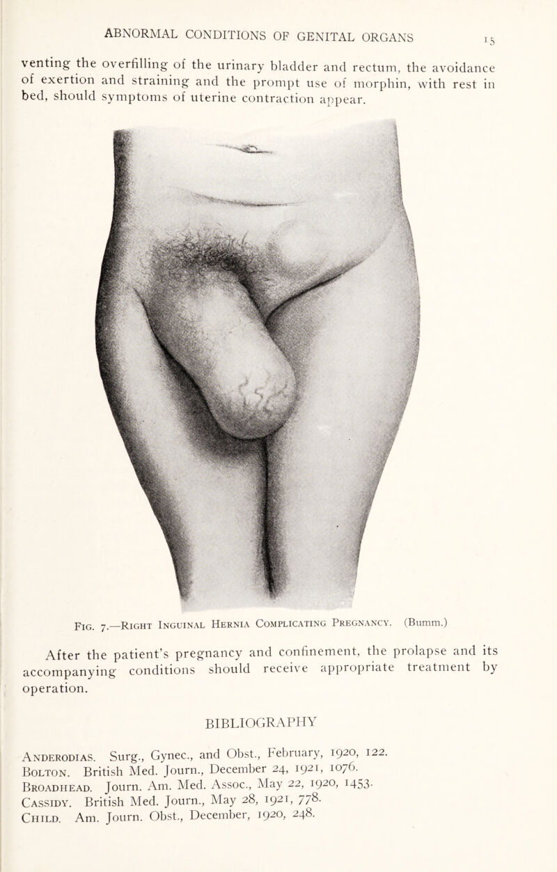 15 venting the overfilling of the urinary bladder and rectum, the avoidance of exertion and straining and the prompt use of morphin, with rest in bed, should symptoms of uterine contraction appear. pIG 7 _right Inguinal Hernia Complicating Pregnancy. (Bumm.) After the patient’s pregnancy and confinement, the prolapse and its accompanying conditions should receive appropriate treatment by operation. BIBLIOGRAPHY Anderodias. Surg., Gynec., and Obst., February, 1920, 122. Bolton. British Med. Journ., December 24, I92L 1076. Broadhead. Journ. Am. Med. Assoc., May 22, 1920, 1453* Cassidy. British Med. Journ., May 28, i92L 77&- Child. Am. Journ. Obst., December, i92°> 248.