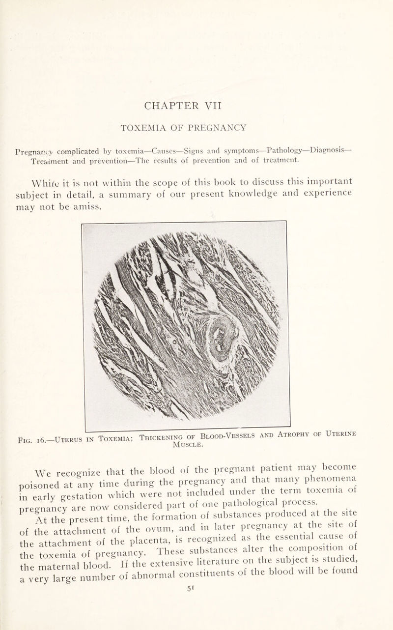 TOXEMIA OF PREGNANCY Pregnancy complicated by toxemia—Causes—Signs and symptoms—Pathology—Diagnosis— Treatment and prevention—The results of prevention and of treatment. White it is not within the scope of this book to discuss this important subject in detail, a summary of our present knowledge and experience may not be amiss. We recognize that the blood of the pregnant patient may become ooisoned at any time during the pregnancy and that many phenomena in early gestation which were not included under the term toxenna of pregnancy are now considered part of one pathological process P It the present time, the formation of substances produced at the site of the attachment of the ovum, and in later pregnancy at the site o the attachment of the placenta, is recognized as the essential cause o o. blood be <o„„d