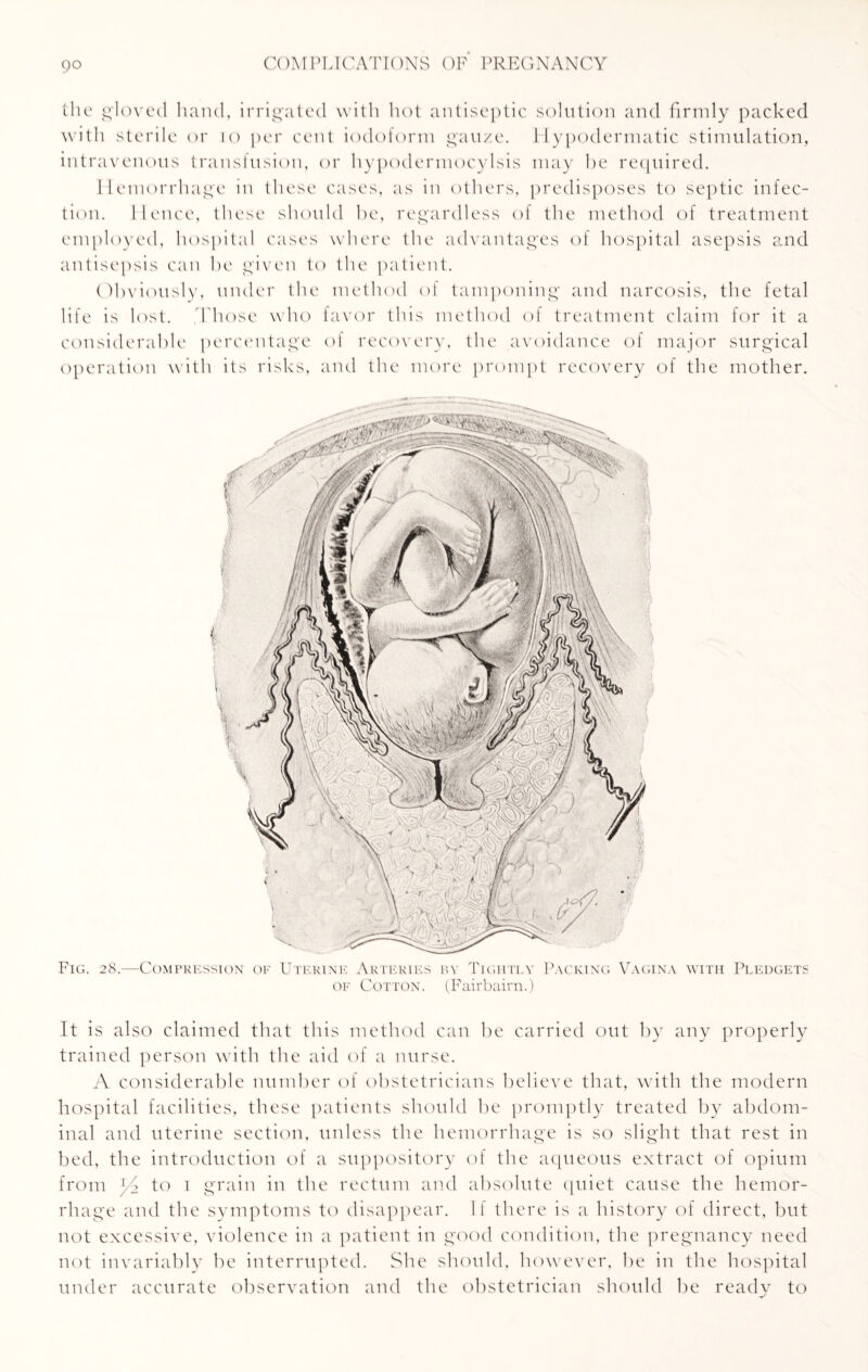 the gloved hand, irrigated with hot antiseptic solution and firmly packed with sterile or 10 per cent iodoform gauze. Hypodermatic stimulation, intravenous transfusion, or hypodermocylsis may he required. Hemorrhage in these cases, as in others, predisposes to septic infec¬ tion. lienee, these should be, regardless of the method of treatment employed, hospital cases where the advantages of hospital asepsis and antisepsis can be given to the patient. Obviously, under the method of tamponing and narcosis, the fetal life is lost. t hose who favor this method of treatment claim for it a considerable percentage of recovery, the avoidance of major surgical operation with its risks, and the more prompt recovery of the mother. of Cotton. (Fairbairn.) It is also claimed that this method can be carried out by any properly trained person with the aid of a nurse. A considerable number of obstetricians believe that, with the modern hospital facilities, these patients should be promptly treated by abdom¬ inal and uterine section, unless the hemorrhage is so slight that rest in bed, the introduction of a suppository of the aqueous extract of opium from j/d to i grain in the rectum and absolute quiet cause the hemor¬ rhage and the symptoms to disappear. If there is a history of direct, but not excessive, violence in a patient in good condition, the pregnancy need not invariably be interrupted. She should, however, be in the hospital under accurate observation and the obstetrician should be ready to