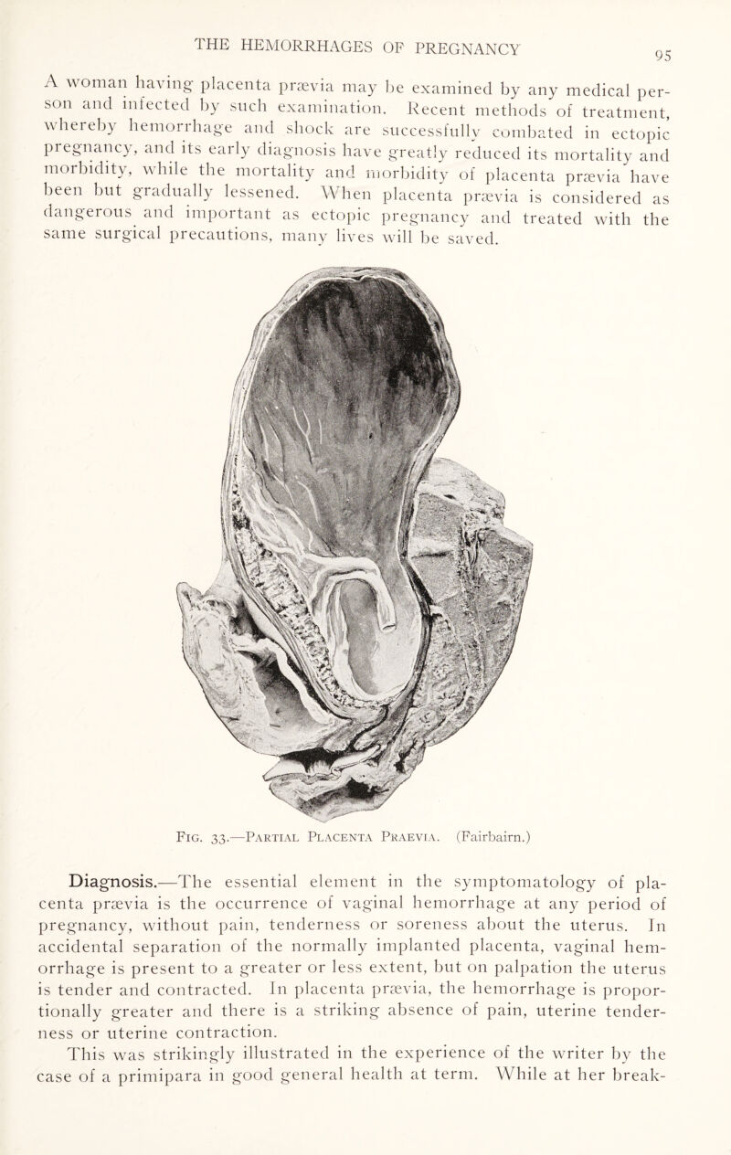 95 A woman having placenta praevia may be examined by any medical per¬ son and infected by such examination. Recent methods of treatment, whereby hemorrhage and shock are successfully combated in ectopic pregnancy, and its early diagnosis have greatly reduced its mortality and morbidity, while the mortality and morbidity of placenta praevia have been but gradually lessened. When placenta praevia is considered as dangerous, and important as ectopic pregnancy and treated with the same surgical precautions, many lives will be saved. Fig. 33.—Partial Placenta Praevia. (Fairbairn.) Diagnosis.—The essential element in the symptomatology of pla¬ centa praevia is the occurrence of vaginal hemorrhage at any period of pregnancy, without pain, tenderness or soreness about the uterus. In accidental separation of the normally implanted placenta, vaginal hem¬ orrhage is present to a greater or less extent, but on palpation the uterus is tender and contracted. In placenta praevia, the hemorrhage is propor¬ tionally greater and there is a striking absence of pain, uterine tender¬ ness or uterine contraction. This was strikingly illustrated in the experience of the writer by the case of a primipara in good general health at term. While at her break-