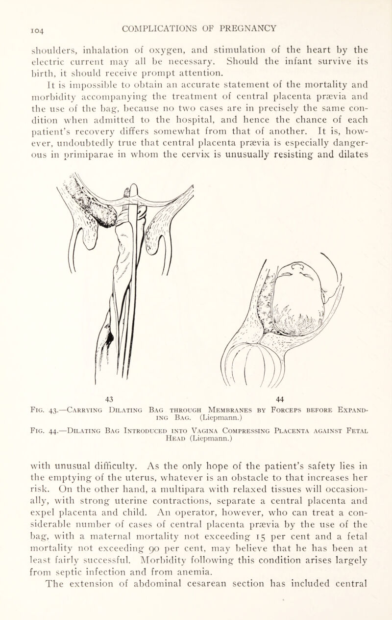 shoulders, inhalation of oxygen, and stimulation of the heart by the electric current may all be necessary. Should the infant survive its birth, it should receive prompt attention. It is impossible to obtain an accurate statement of the mortality and morbidity accompanying the treatment of central placenta praevia and the use of the bag, because no two cases are in precisely the same con¬ dition when admitted to the hospital, and hence the chance of each patient’s recovery differs somewhat from that of another. It is, how¬ ever, undoubtedly true that central placenta praevia is especially danger¬ ous in primiparae in whom the cervix is unusually resisting and dilates 43 44 Fig. 43.—Carrying Dilating Bag through Membranes by Forceps before Expand¬ ing Bag. (Liepmann.) Fig. 44.—Dilating Bag Introduced into Vagina Compressing Placenta against Fetal Head (Liepmann.) with unusual difficulty. As the only hope of the patient’s safety lies in the emptying of the uterus, whatever is an obstacle to that increases her risk. On the other hand, a multipara with relaxed tissues will occasion¬ ally, with strong uterine contractions, separate a central placenta and expel placenta and child. An operator, however, who can treat a con¬ siderable number of cases of central placenta praevia by the use of the bag, with a maternal mortality not exceeding 15 per cent and a fetal mortality not exceeding 90 per cent, may believe that he has been at least fairly successful. Morbidity following this condition arises largely from septic infection and from anemia. The extension of abdominal cesarean section has included central