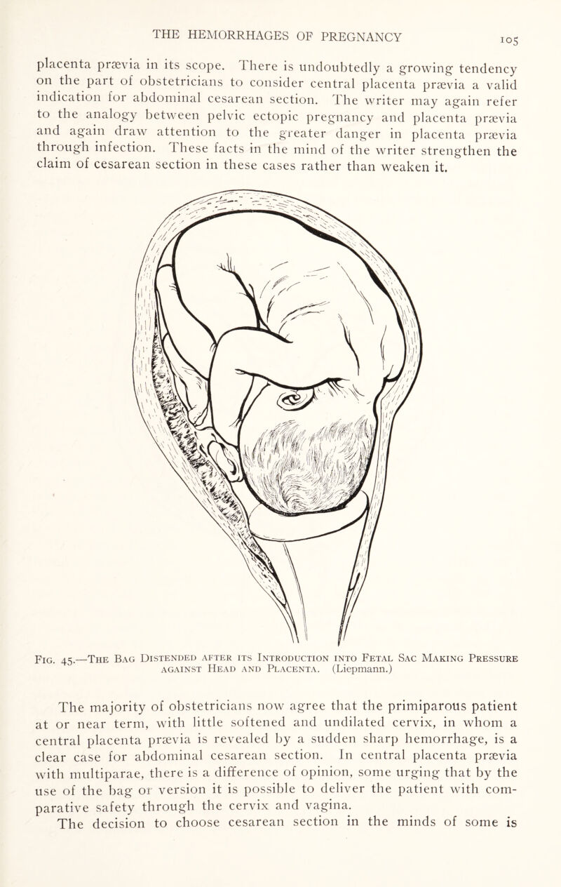 placenta prsevia in its scope, there is undoubtedly a growing tendency on the part of obstetricians to consider central placenta prsevia a valid indication for abdominal cesarean section. The writer may again refer to the analogy between pelvic ectopic pregnancy and placenta prsevia and again draw attention to the greater danger in placenta prsevia through infection, these facts in the mind of the writer strengthen the claim of cesarean section in these cases rather than weaken it. Fig. 45.—The Bag Distended after its Introduction into Fetal Sac Making Pressure against Head and Placenta. (Liepmann.) The majority of obstetricians now agree that the primiparous patient at or near term, with little softened and undilated cervix, in whom a central placenta prsevia is revealed by a sudden sharp hemorrhage, is a clear case for abdominal cesarean section. In central placenta prsevia with multiparae, there is a difference of opinion, some urging that by the use of the bag or version it is possible to deliver the patient with com¬ parative safety through the cervix and vagina. The decision to choose cesarean section in the minds of some is