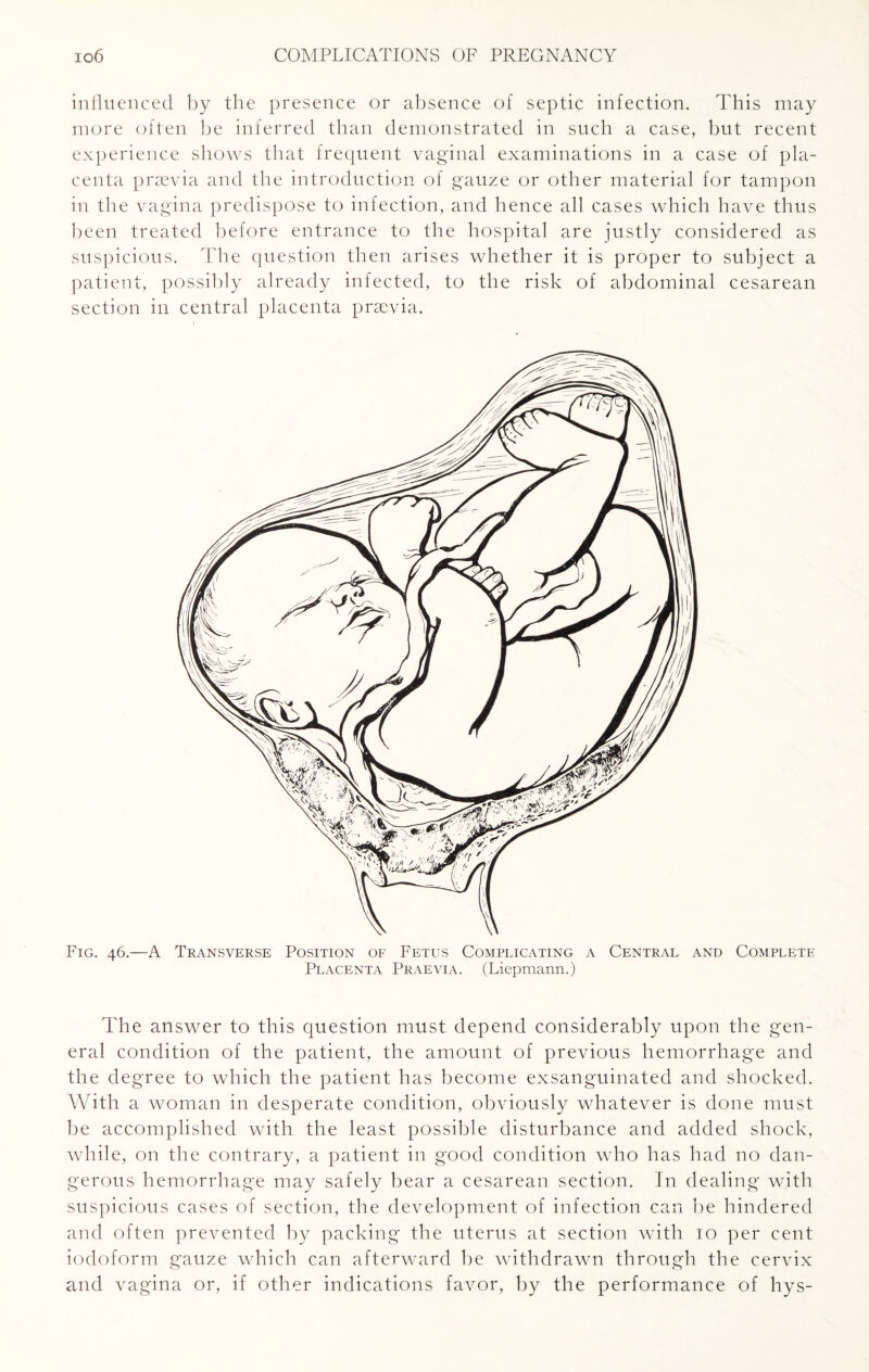 influenced by the presence or absence of septic infection. This may more often be inferred than demonstrated in such a case, but recent experience shows that frequent vaginal examinations in a case of pla¬ centa prsevia and the introduction of gauze or other material for tampon in the vagina predispose to infection, and hence all cases which have thus been treated before entrance to the hospital are justly considered as suspicious. The question then arises whether it is proper to subject a patient, possibly already infected, to the risk of abdominal cesarean section in central placenta prsevia. Fig. 46.—A Transverse Position of Fetus Complicating a Central and Complete Placenta Praevia. (Liepmann.) The answer to this question must depend considerably upon the gen¬ eral condition of the patient, the amount of previous hemorrhage and the degree to which the patient has become exsanguinated and shocked. With a woman in desperate condition, obviously whatever is done must be accomplished with the least possible disturbance and added shock, while, on the contrary, a patient in good condition who has had no dan¬ gerous hemorrhage may safely bear a cesarean section. In dealing with suspicious cases of section, the development of infection can be hindered and often prevented by packing the uterus at section with 10 per cent iodoform gauze which can afterward be withdrawn through the cervix and vagina or, if other indications favor, by the performance of hys-