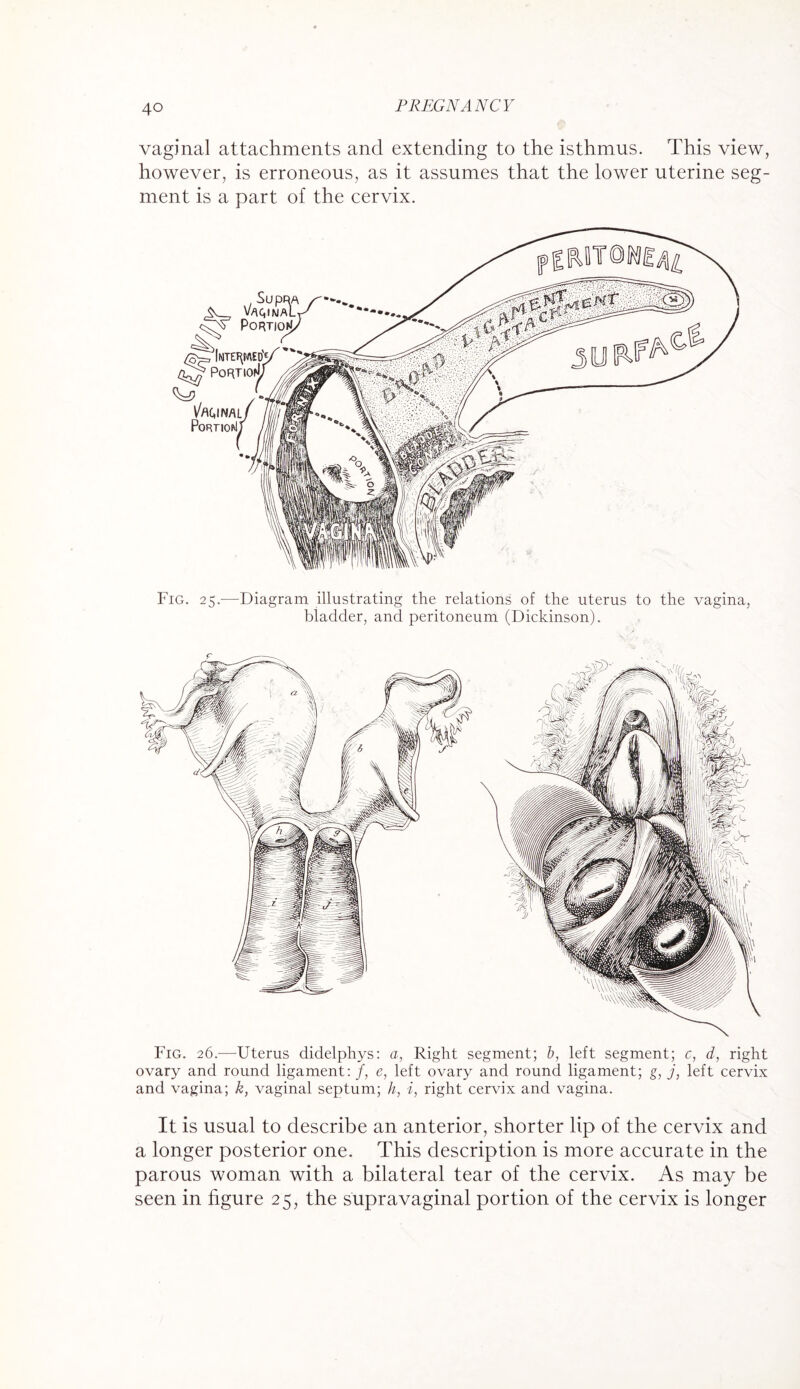 vaginal attachments and extending to the isthmus. This view, however, is erroneous, as it assumes that the lower uterine seg¬ ment is a part of the cervix. Fig. 25.—Diagram illustrating the relations of the uterus to the vagina, bladder, and peritoneum (Dickinson). Fig. 26.-—-Uterus didelphys: a, Right segment; b, left segment; c, d, right ovary and round ligament: f, e, left ovary and round ligament; g, j, left cervix and vagina; k, vaginal septum; h, i, right cervix and vagina. It is usual to describe an anterior, shorter lip of the cervix and a longer posterior one. This description is more accurate in the parous woman with a bilateral tear of the cervix. As may be seen in figure 25, the supravaginal portion of the cervix is longer