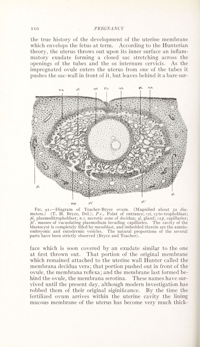 the true history of the development of the uterine membrane which envelops the fetus at term. According to the Hunterian theory, the uterus throws out upon its inner surface an inflam¬ matory exudate forming a closed sac stretching across the openings of the tubes and the os internum cervicis. As the impregnated ovule enters the uterus from one of the tubes it pushes the sac-wall in front of it, but leaves behind it a bare sur- Fig. 91.—Diagram of Teacher-Bryce ovum. (Magnified about 50 dia¬ meters.) (T. H. Bryce, Del.); P.e., Point of entrance; cyt, cyto-trophoblast; pi, plasmoditrophoblast; n.z. necrotic zone of decidua; gl, gland; cap, capillaries; plr, masses of vacuolating plasmodium invading capillaries. The cavity of the blastocyst is completely filled by mesoblast, and imbedded therein are the amnio- embryonic and entodermic vesicles. The natural proportions of the several parts have been strictly observed (Bryce and Teacher). face which is soon covered by an exudate similar to the one at first thrown out. That portion of the original membrane which remained attached to the uterine wall Hunter called the membrana decidua vera; that portion pushed out in front of the ovule, the membrana reflexa; and the membrane last formed be¬ hind the ovule, the membrana serotina. These names have sur¬ vived until the present day, although modern investigation has robbed them of their original siginihcance. By the time the fertilized ovum arrives within the uterine cavity the lining mucous membrane of the uterus has become very much thick-