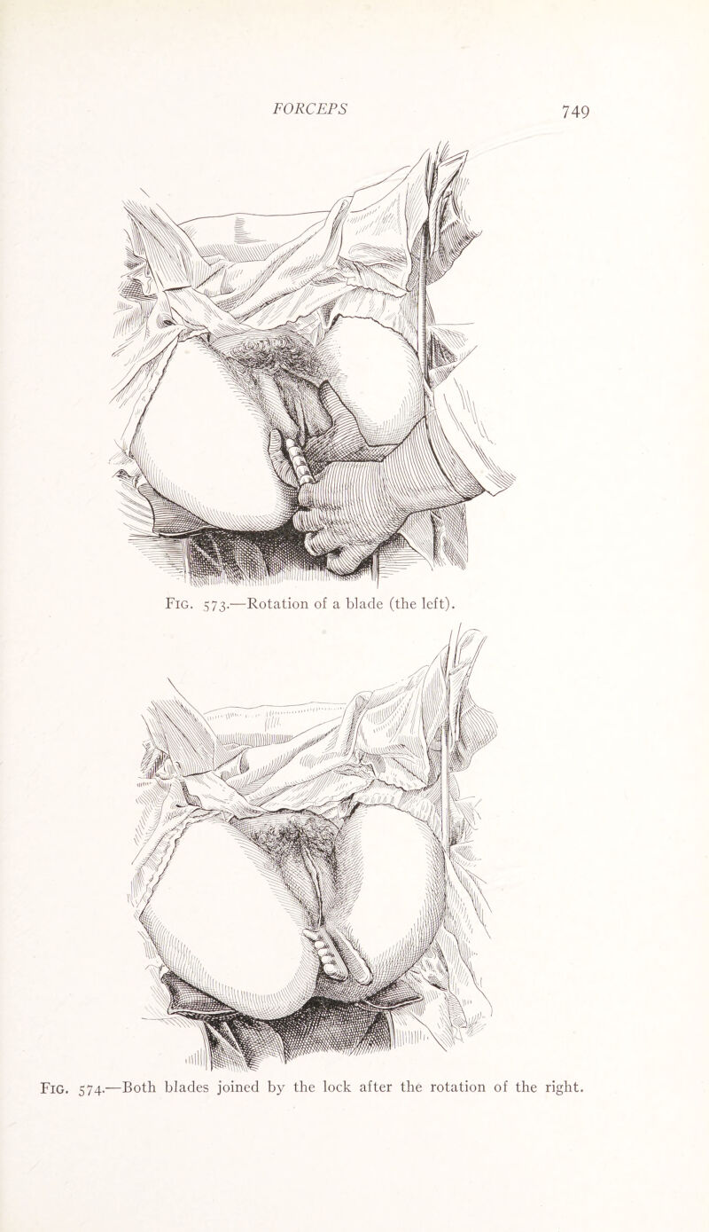 Fig. 573.—Rotation of a blade (the left). Fig. 574.—Both blades joined by the lock after the rotation of the right.