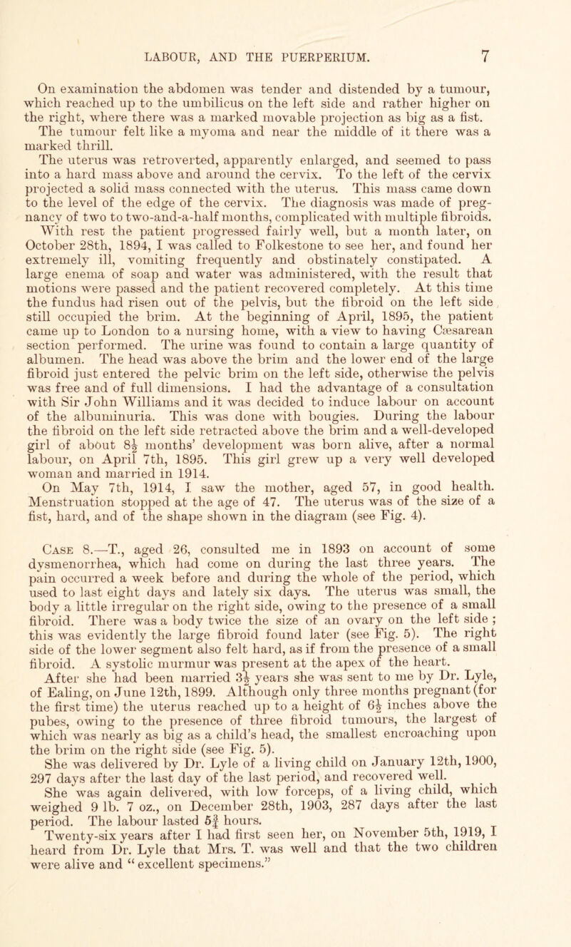 On examination the abdomen was tender and distended by a tumour, which reached up to the umbilicus on the left side and rather higher on the right, where there was a marked movable projection as big as a fist. The tumour felt like a myoma and near the middle of it there was a marked thrill. The uterus was retroverted, apparently enlarged, and seemed to pass into a hard mass above and around the cervix. To the left of the cervix projected a solid mass connected with the uterus. This mass came down to the level of the edge of the cervix. The diagnosis was made of preg¬ nancy of two to two-and-a-half months, complicated with multiple fibroids. With rest the patient progressed fairly well, but a month later, on October 28th, 1894, I was called to Folkestone to see her, and found her extremely ill, vomiting frequently and obstinately constipated. A large enema of soap and water was administered, with the result that motions were passed and the patient recovered completely. At this time the fundus had risen out of the pelvis, but the fibroid on the left side still occupied the brim. At the beginning of April, 1895, the patient came up to London to a nursing home, with a view to having Caesarean section performed. The urine was found to contain a large quantity of albumen. The head was above the brim and the lower end of the large fibroid just entered the pelvic brim on the left side, otherwise the pelvis was free and of full dimensions. I had the advantage of a consultation with Sir John Williams and it was decided to induce labour on account of the albuminuria. This was done with bougies. During the labour the fibroid on the left side retracted above the brim and a well-developed girl of about 8^ months’ development was born alive, after a normal labour, on April 7th, 1895. This girl grew up a very well developed woman and married in 1914. On May 7th, 1914, I saw the mother, aged 57, in good health. Menstruation stopped at the age of 47. The uterus was of the size of a fist, hard, and of the shape shown in the diagram (see Fig. 4). Case 8.—T., aged 26, consulted me in 1893 on account of some dysmenorrhea, which had come on during the last three years. The pain occurred a week before and during the whole of the period, which used to last eight days and lately six days. The uterus was small, the body a little irregular on the right side, owing to the presence of a small fibroid. There was a body twice the size of an ovary on the left side ; this was evidently the large fibroid found later (see Fig. 5). The right side of the lower segment also felt hard, as if from the presence of a small fibroid. A systolic murmur was present at the apex of the heart. After she had been married 3^ years she was sent to me by Dr. Lyle, of Ealing, on June 12th, 1899. Although only three months pregnant (for the first time) the uterus reached up to a height of 6^ inches above the pubes, owing to the presence of three fibroid tumours, the largest of which was nearly as big as a child’s head, the smallest encroaching upon the brim on the right side (see Fig. 5). She was delivered by Dr. Lyle of a living child on January 12th, 1900, 297 days after the last day of the last period, and recovered well. She was again delivered, with low forceps, of a living child, which weighed 9 lb. 7 oz., on December 28th, 1903, 287 days after the last period. The labour lasted 5f hours. Twenty-six years after I had first seen her, on November 5th, 1919, I heard from Dr. Lyle that Mrs. T. was well and that the two children were alive and “ excellent specimens.”