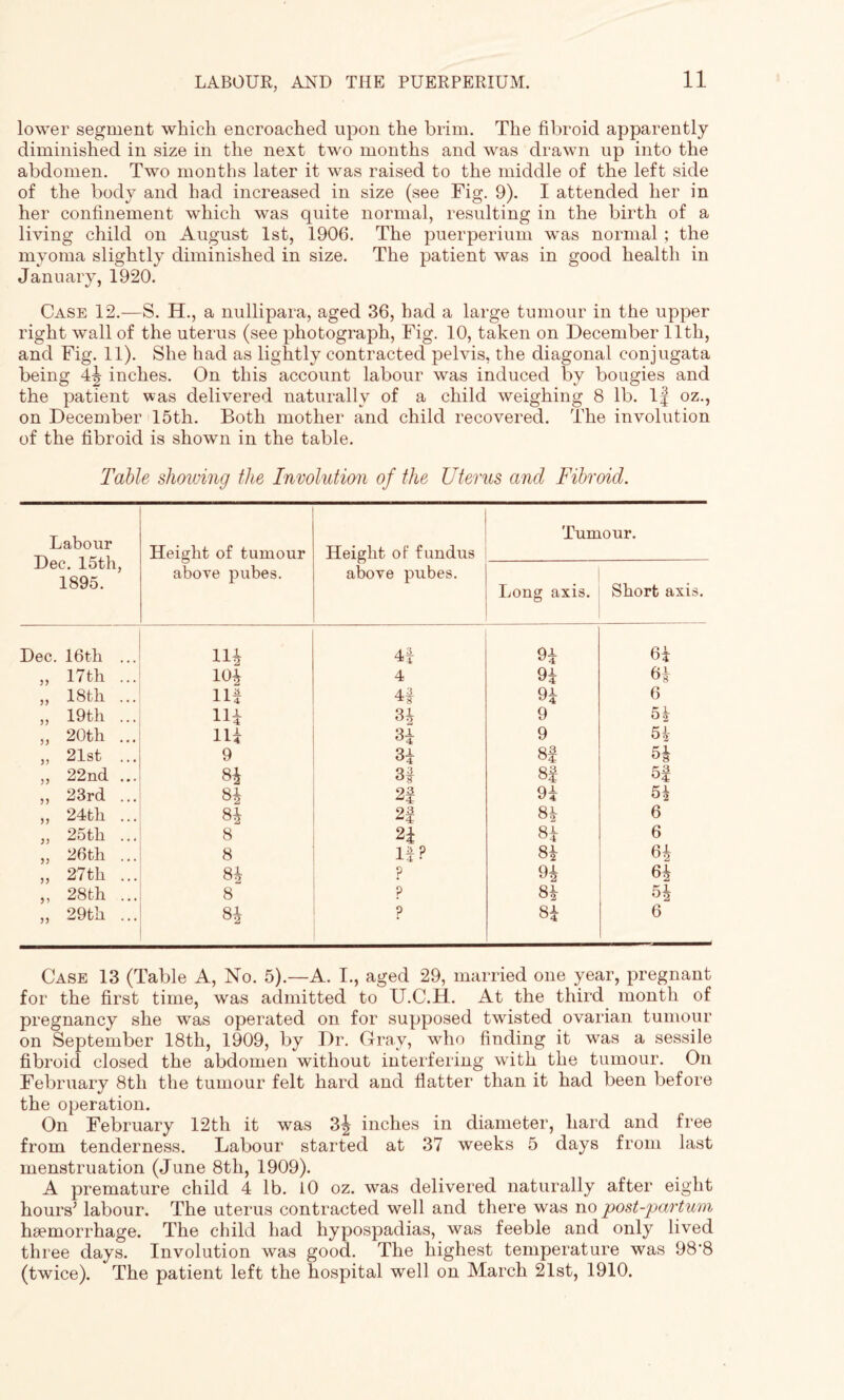 lower segment which encroached upon the brim. The fibroid apparently diminished in size in the next two months and was drawn up into the abdomen. Two months later it was raised to the middle of the left side of the body and had increased in size (see Fig. 9). I attended her in her confinement which was quite normal, resulting in the birth of a living child on August 1st, 1906. The puerperium was normal ; the myoma slightly diminished in size. The patient was in good health in January, 1920. Case 12.—S. H., a nullipara, aged 36, had a large tumour in the upper right wall of the uterus (see photograph, Fig. 10, taken on December 11th, and Fig. 11). She had as lightly contracted pelvis, the diagonal conjugata being 4^ inches. On this account labour was induced by bougies and the patient was delivered naturally of a child weighing 8 lb. If oz., on December 15th. Both mother and child recovered. The involution of the fibroid is shown in the table. Table showing the Involution of the Uterus and Fibroid. Labour Dec. 15th, 1895. Height of tumour above pubes. Height of fundus above pubes. Tumour. Long axis. Short axis. Dec. 16th ... Ill 4f 94 64 „ 17th ... 104 4 94 64 „ 18th ... Hf 4f 94 6 ,, 19th ... Hi 34 9 54 „ 20th ... Hi 34 9 54 „ 21st ... 9 34 8f 54 ,, 22nd ... 3f 8f 5f ,, 23rd ... 84 2f 94 54 „ 24th ... 84 0 3 84 6 ,, 25th ... 8 24 84 6 „ 26th ... 8 If? 84 64 „ 27th ... 84 ? 94 64 ,, 28th ... 8 p 84 54 „ 29th ... 84 p 84 6 Case 13 (Table A, No. 5).—A. I., aged 29, married one year, pregnant for the first time, was admitted to U.C.H. At the third month of pregnancy she was operated on for supposed twisted ovarian tumour on September 18th, 1909, by Dr. Gray, who finding it was a sessile fibroid closed the abdomen without interfering with the tumour. On February 8th the tumour felt hard and flatter than it had been before the operation. On February 12th it was 34 inches in diameter, hard and free from tenderness. Labour started at 37 weeks 5 days from last menstruation (June 8th, 1909). A premature child 4 lb. 10 oz. was delivered naturally after eight hours’ labour. The uterus contracted well and there was no post-partum haemorrhage. The child had hypospadias, was feeble and only lived three days. Involution was good. The highest temperature was 98'8 (twice). The patient left the hospital well on March 21st, 1910.