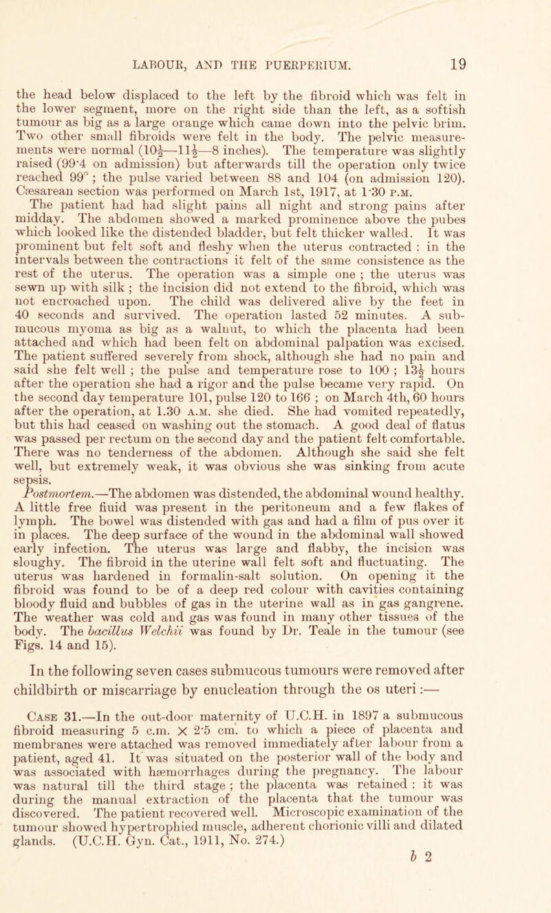 the head below displaced to the left by the fibroid which wras felt in the lower segment, more on the right side than the left, as a softish tumour as big as a large orange which came down into the pelvic brim. Two other small fibroids were felt in the body. The pelvic measure¬ ments were normal (10^—11\—8 inches). The temperature was slightly raised (99‘4 on admission) but afterwards till the operation only twice reached 99° ; the pulse varied between 88 and 104 (on admission 120). Caesarean section was performed on March 1st, 1917, at 130 p.m. The patient had had slight pains all night and strong pains after midday. The abdomen showed a marked prominence above the pubes which looked like the distended bladder, but felt thicker walled. It was prominent but felt soft and fleshy when the uterus contracted : in the intervals between the contractions it felt of the same consistence as the rest of the uterus. The operation was a simple one ; the uterus was sewn up with silk ; the incision did not extend to the fibroid, which was not encroached upon. The child was delivered alive by the feet in 40 seconds and survived. The operation lasted 52 minutes. A sub¬ mucous myoma as big as a walnut, to which the placenta had been attached and which had been felt on abdominal palpation was excised. The patient suffered severely from shock, although she had no pain and said she felt well ; the pulse and temperature rose to 100 ; 13^ hours after the operation she had a rigor and the pulse became very rapid. On the second day temperature 101, pulse 120 to 166 ; on March 4th, 60 hours after the operation, at 1.30 a.m. she died. She had vomited repeatedly, but this had ceased on washing out the stomach. A good deal of flatus was passed per rectum on the second day and the patient felt comfortable. There was no tenderness of the abdomen. Although she said she felt well, but extremely weak, it was obvious she was sinking from acute sepsis. Postmortem.—The abdomen was distended, the abdominal wound healthy. A little free fluid was present in the peritoneum and a few flakes of lymph. The bowel was distended with gas and had a film of pus over it in places. The deep surface of the wound in the abdominal wall showed early infection. The uterus was large and flabby, the incision was sloughy. The fibroid in the uterine wall felt soft and fluctuating. The uterus was hardened in formalin-salt solution. On opening it the fibroid was found to be of a deep red colour with cavities containing bloody fluid and bubbles of gas in the uterine wall as in gas gangrene. The weather was cold and gas was found in many other tissues of the body. The bacillus Welchii was found by Dr. Teale in the tumour (see Figs. 14 and 15). In the following seven cases submucous tumours were removed after childbirth or miscarriage by enucleation through the os uteri:— Case 31.—In the out-door maternity of U.C.H. in 1897 a submucous fibroid measuring 5 c.m. X 2’5 cm. to which a piece of placenta and membranes were attached was removed immediately after labour from a patient, aged 41. It was situated on the posterior wall of the body and was associated with haemorrhages during the pregnancy. The labour was natural till the third stage ; the placenta was retained : it was during the manual extraction of the placenta that the tumour was discovered. The patient recovered well. Microscopic examination of the tumour showed hypertrophied muscle, adherent chorionic villi and dilated glands. (U.C.H. Gyn. Cat., 1911, No. 274.) b 2
