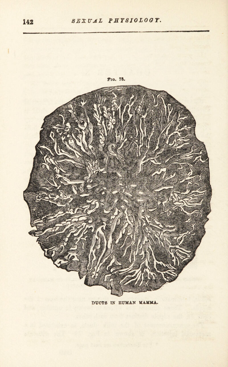 Fig. 78. DU0T8 IN HUMAN MAMMA.