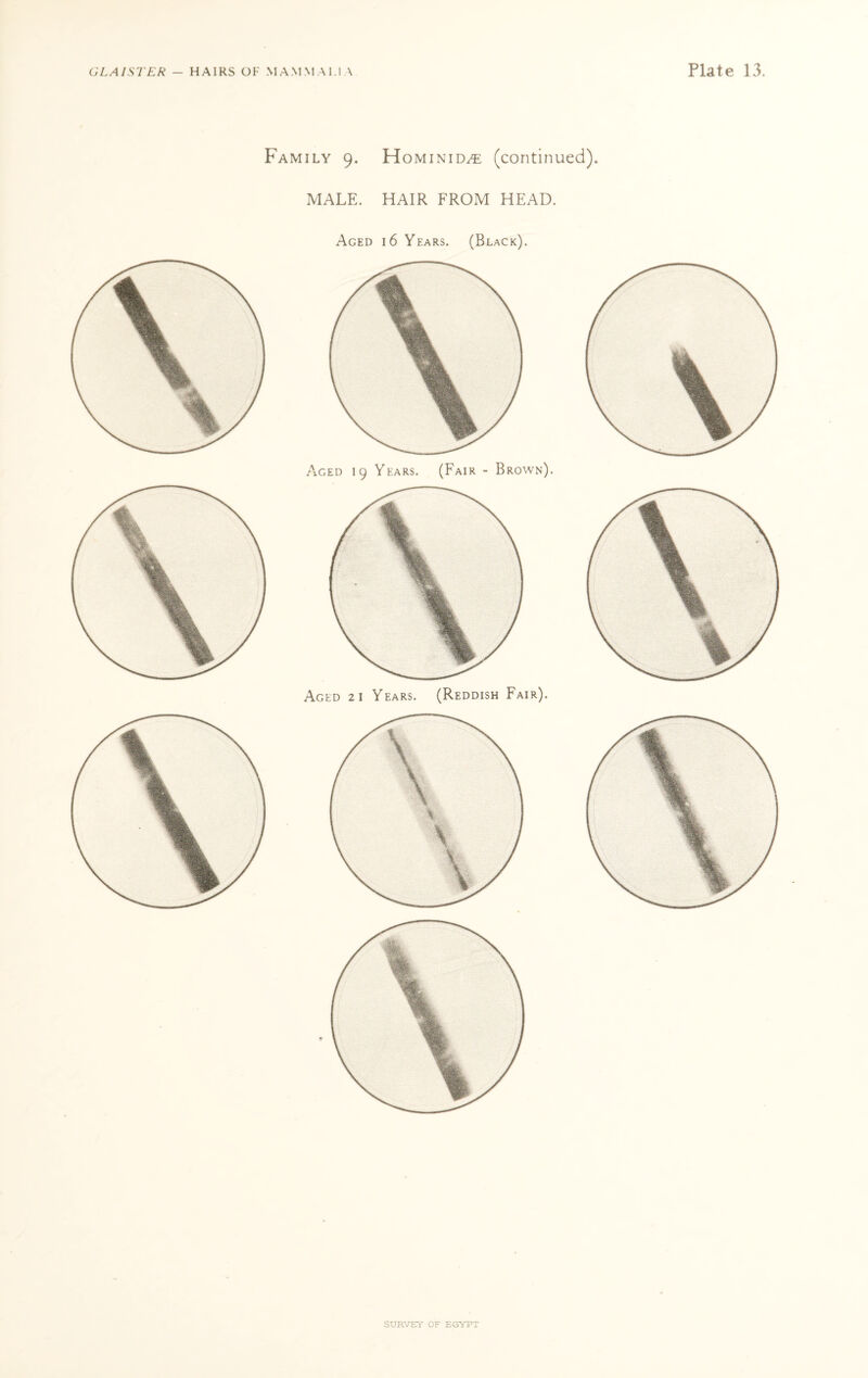 Family 9. Hominim; (continued). MALE. HAIR FROM HEAD. Aged 16 Years. (Black). Aged 19 Years. (Fair - Brown). Aged 21 Years. (Reddish Fair). r