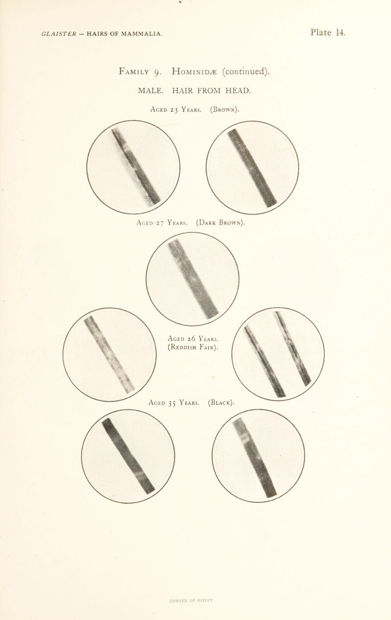 % Family 9. Hominid^ (continued). MALE. HAIR FROM HEAD. Aged 23 Years. (Brown). Aged*27 Years. (Dark Brown).