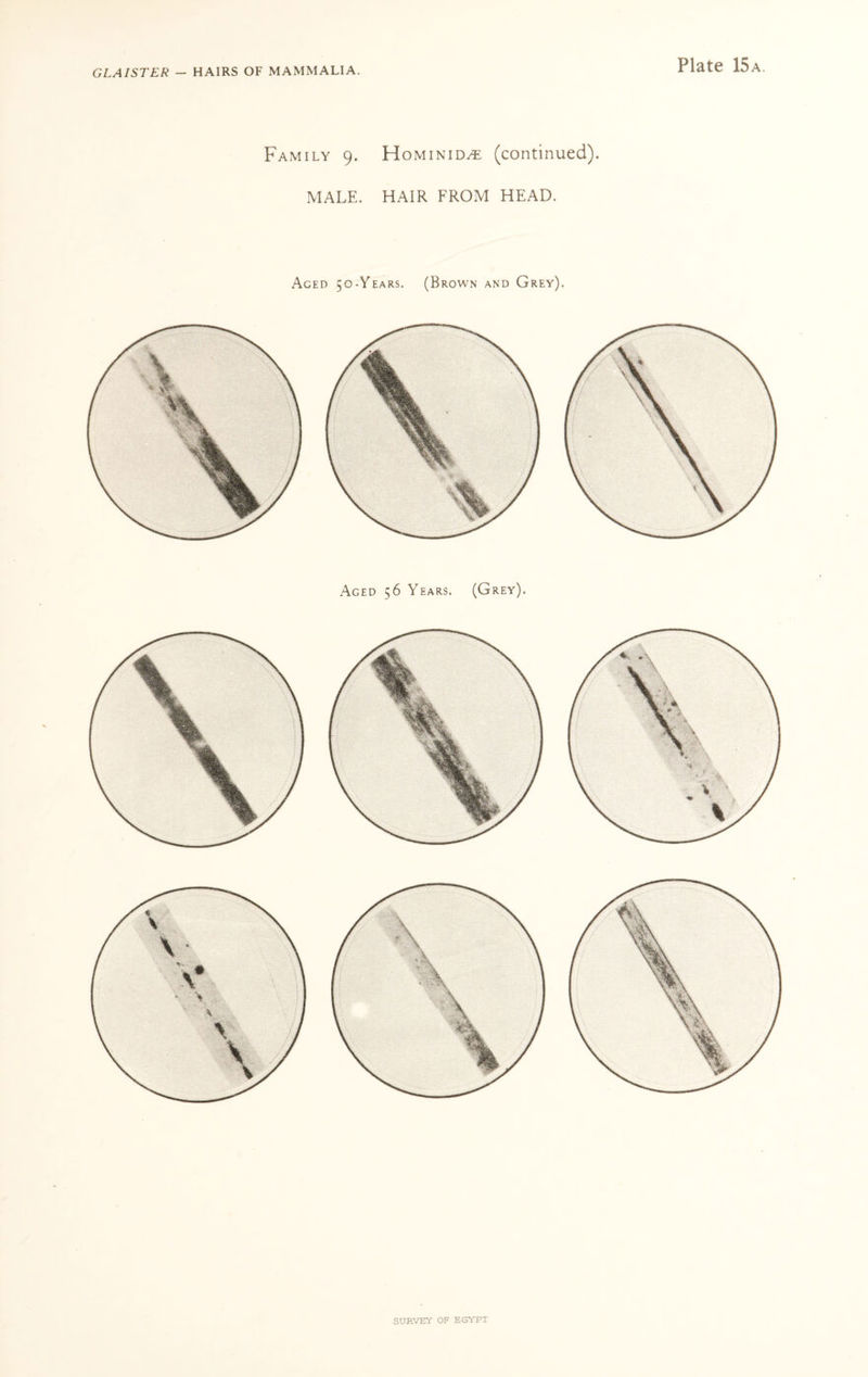 Family 9. Hominid/e (continued). MALE. HAIR FROM HEAD. Aged 50-Years. (Brown and Grey). Aged 56 Years. (Grey).