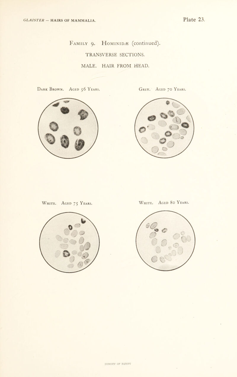 Family 9. Hominid^e (continued). TRANSVERSE SECTIONS. MALE. HAIR FROM HEAD. Dark Brown. Aged 56 Years. Grey. Aged 70 Years. White. Aged 75 Years. White. Aged 80 Years.