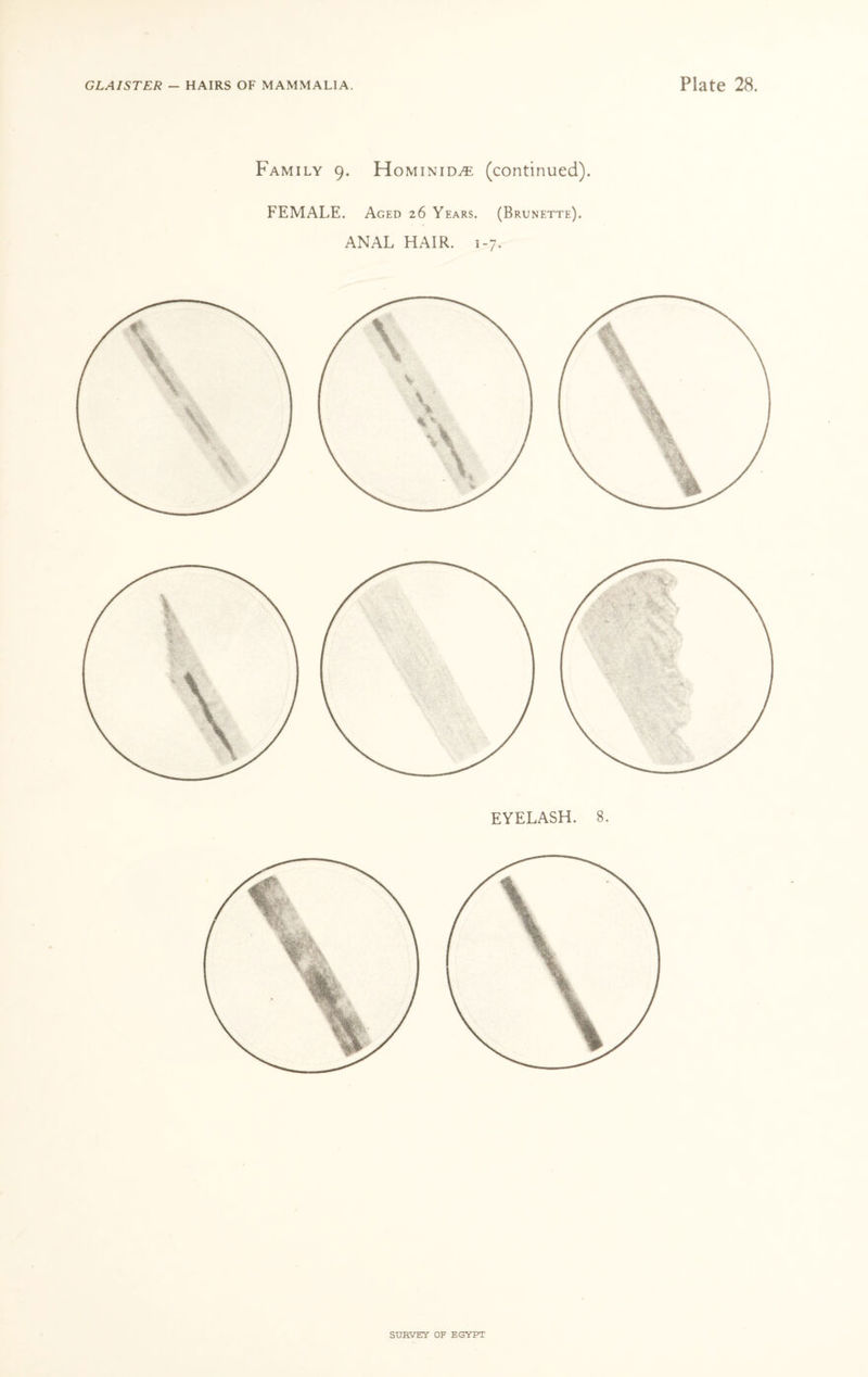 Family 9. Hominid^e (continued). FEMALE. Aged 26 Years. (Brunette). ANAL HAIR. 1-7. EYELASH. 8.