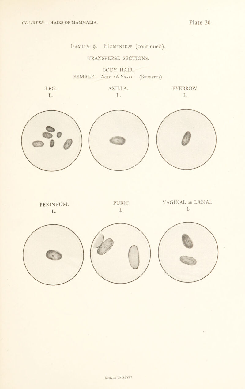 Family 9. Hominid^: (continued). TRANSVERSE SECTIONS. BODY HAIR. FEMALE. Aged 26 Years. (Brunette). LEG. AXILLA. L. L. EYEBROW. L. PERINEUM. L. PUBIC. L. VAGINAL or LABIAL. L.