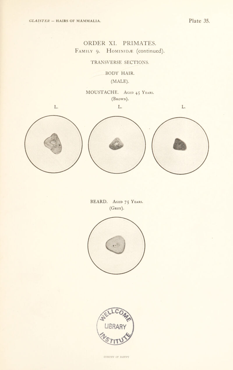 ORDER XI. PRIMATES. Family 9. Hominid^: (continued). TRANSVERSE SECTIONS. BODY HAIR. (MALE). MOUSTACHE. Aged 45 Years. (Brown). L. L. L. BEARD. Aged 75 Years. (Grey).