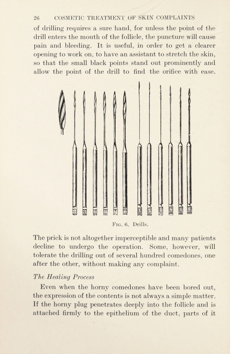 of drilling requires a sure hand, for unless the point of the drill enters the mouth of the follicle, the puncture will cause pain and bleeding. It is useful, in order to get a clearer opening to work on, to have an assistant to stretch the skin, so that the small black points stand out prominently and allow the point of the drill to find the orifice with ease. / 1 \ - 1 r s r j ,f J L - i ■ ■H r : 2 1 j i 3 U h e5 |s 1 E i r i IS ml in FI ■ 1 I m 3 = % t - — 1 M Fig. 6. Drills. The prick is not altogether imperceptible and many patients decline to undergo the operation. Some, however, will tolerate the drilling out of several hundred comedones, one after the other, without making any complaint. The Healing Process Even when the horny comedones have been bored out, the expression of the contents is not always a simple matter. If the horny plug penetrates deeply into the follicle and is attached firmly to the epithelium of the duct, parts of it