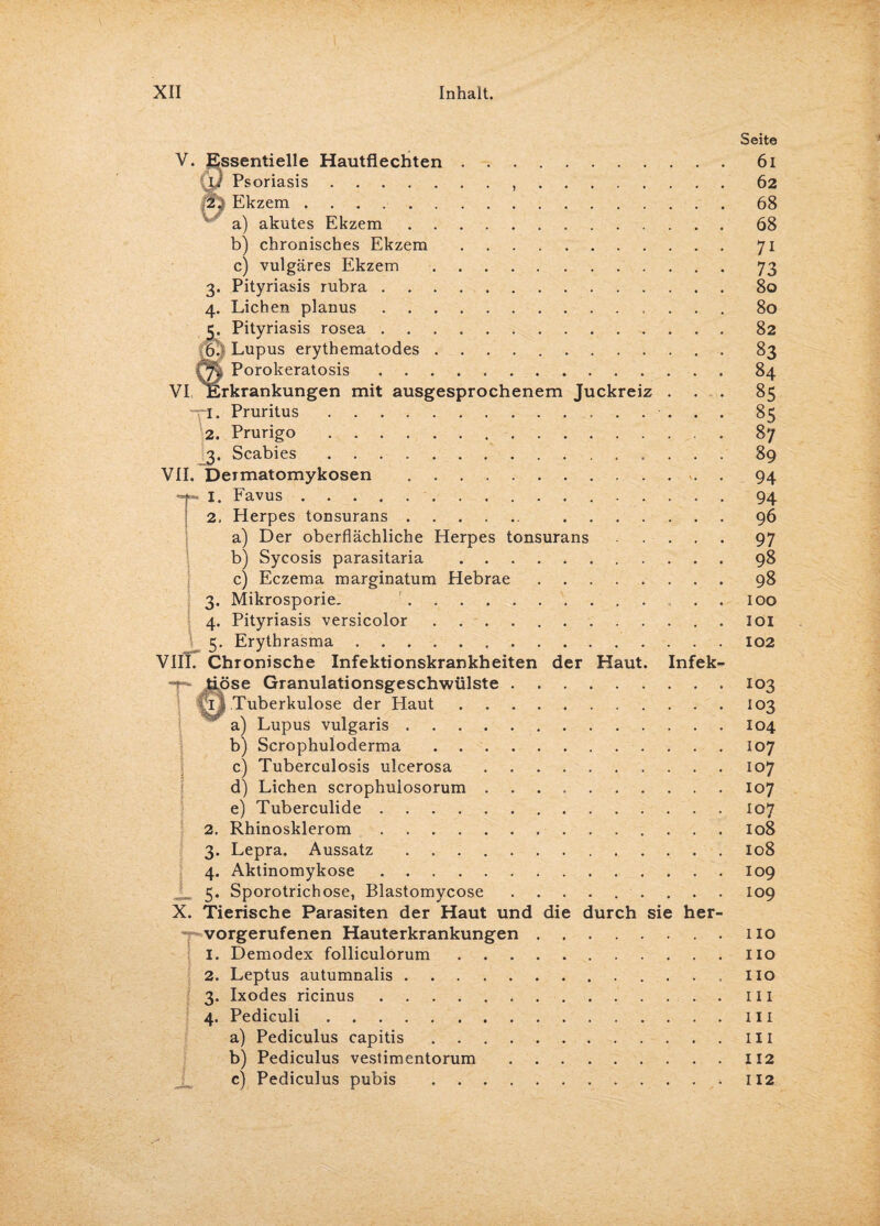 V. Essentielle Hautflechten. Psoriasis... Ekzem .. a) akutes Ekzem. b) chronisches Ekzem. c) vulgäres Ekzem . 3. Pityriasis rubra. 4. Lichen planus. ij. Pityriasis rosea. 6. Lupus erythematodes .. Qi Porokeratosis. VI Erkrankungen mit ausgesprochenem Juckreiz . -ri. Pruritus.. 2. Prurigo. 3. Scabies. VII. Dermatomykosen .. . 1. Favus.. 2. Herpes tonsurans.. . a) Der oberflächliche Herpes tonsurans. b) Sycosis parasitaria . c) Eczema marginatum Hebrae. 3. Mikrosporie. . . . 4. Pityriasis versicolor. 5. Erythrasma. VIII. Chronische Infektionskrankheiten der Haut. Infek- T tiöse Granulationsgeschwülste. #t 1 Tuberkulose der Haut. a) Lupus vulgaris. b) Scrophuloderma. c) Tuberculosis ulcerosa. d) Lichen scrophulosorum. e) Tuberculide. 2. Rhinosklerom. 3. Lepra. Aussatz. 4. Aktinomykose. 5. Sporotrichose, Blastomycose. X. Tierische Parasiten der Haut und die durch sie her¬ vorgerufenen Hauterkrankungen. I. Demodex folliculorum. 2. Leptus autumnalis. 3. Ixodes ricinus. 4. Pediculi. a) Pediculus capitis. b) Pediculus vestimentorum. c) Pediculus pubis . Seite 61 62 68 68 7i 73 80 80 82 83 84 85 85 87 89 94 94 96 97 98 98 100 101 102 103 103 104 107 107 107 107 108 108 109 109 I IO HO 110 1 I I I I I 111 112 I 12