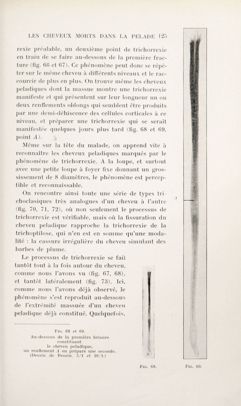 rexie préalable, un deuxième point de trichorrexie en train de se faire au-dessous de la première frac¬ ture (fig. 66 et 67). Ce phénomène peut donc se répé¬ ter sur le même cheveu à différents niveaux et le rac¬ courcir de plus en plus. On trouve même les cheveux peladiques dont la massue montre une trichorrexie manifeste et qui présentent sur leur longueur un ou deux renflements oblongs qui semblent être produits par une demi-déhiscence des cellules corticales à ce niveau, et préparer une trichorrexie qui se serait manifestée quelques jours plus tard (fig. 68 et 69, point A). Même sur la tête du malade, on apprend vite à reconnaître les cheveux peladiques marqués par le phénomène de trichorrexie. A la loupe, et surtout avec une petite loupe à foyer fixe donnant un gros¬ sissement de 8 diamètres, le phénomène est percep¬ tible et reconnaissable. On rencontre ainsi toute une série de types tri - choclasiques très analogues d’un cheveu à Tautre (fig. 70, 71, 72), où non seulement le processus de trichorrexie est vérifiable, mais où la fissuration du cheveu peladique rapproche la trichorrexie de la trichoptilose, qui n’en est en somme qu’une moda¬ lité : la cassure irrégulière du cheveu simulant des barbes de plume. Le processus de trichorrexie se fait tantôt tout à la fois autour du cheveu, comme nous l’avons vu (fig. 67, 68), et tantôt latéralement (fig. 73). Ici, comme nous l’avons déjà observé, le phénomène s’est reproduit au-dessous de l’extrémité massuée d’un cheveu peladique déjà constitué. Quelquefois, Fig. 68 et 69. Au-dessous (le la première brisure constituant le cheveu peladique, un renflement A en prépare une seconde. (Dessin de Bessin. 5/1 et 20/1.) fl *4 -V * T — HE t •i. w'PSSB