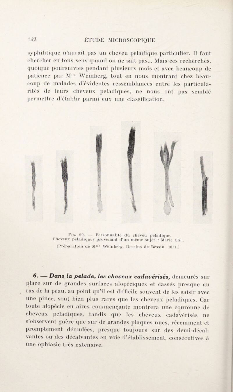 syphilitique n’aurait pas un cheveu peladique particulier. Il faut chercher en tous sens quand on ne sait pas... Mais ces recherches, quoique poursuivies pendant plusieurs mois et avec beaucoup de patience par M le Weinberg, tout en nous montrant chez beau¬ coup de malades d’évidentes ressemblances entre les particula¬ rités de leurs cheveux peladiques, ne nous ont pas semblé permettre d’établir parmi eux une classification. Fig. 99. — Personnalité du cheveu peladique. Cheveux peladiques provenant d’un même sujet : Marie Ch... (Préparation de M1Ie Weinberg. Dessins de Bessin. 10/1.) — Dans la pelade, les cheveux cadavérisés, demeurés sur place sur de grandes surfaces alopéciques et cassés presque au ras de la peau, au point qu’il est difficile souvent de les saisir avec une pince, sont bien plus rares que les cheveux peladiques. Car toute alopécie en aires commençante montrera une couronne de cheveux peladiques, tandis que les cheveux cadavérisés ne s observent guère que sur de grandes plaques nues, récemment et promptement dénudées, presque toujours sur des demi-décal- vantes ou des décalvantes en voie d’établissement, consécutives à une ophiasie très extensive.